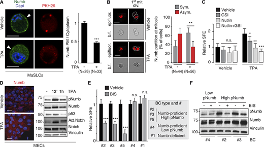 PKCs and Numb phosphorylation in human BCs. (A) Left: MaSLCs (PKHpos cells) were treated with 1 μM TPA (12 min) and stained with anti-Numb and DAPI. PHK26 (red), Numb (green), DAPI (blue). Arrowheads point to PM. Bar, 10 μm. Right: Quantitation of experiment, data are expressed as the ratio between plasma membrane (PM) Numb and cytoplasmic Numb, relative to vehicle. (B) Left: Numb partitioning at mitosis of MaSLCs (1st mit. div.), treated as indicated (TPA, 1 μM for the duration of the experiment). Bar, 10 μm. b.f., bright-field.; epifluorescence (red). Right: Quantitation of the experiment, showing the frequency of symmetric (Sym) vs. asymmetric (Asym) partitioning of Numb. (C) SFE of mouse WT MECs treated as indicated (TPA treatment as in B, other drugs as in Fig. 8); data are relative to Vehicle control (see also Table S2). (D) Left: Numb confocal immunofluorescence in MECs treated with TPA as in A. Numb (red), DAPI (blue); Bar, 20 μm. Right: IB of MECs treated with TPA (1 μM) for the indicated time. (E) SFE, in the presence of BIS of the indicated BC primary cultures. (F) The indicated BC primary cultures were treated with BIS (3 μM o/n) and IB as shown. When shown: N, number of cells or doublets analyzed, as appropriate. Data are reported ± SD (B, C, and E) or ± SE (A). Statistical analysis was with the nonparametric Fisher’s exact test (B) or with the Student’s t test two-tailed (A, C, and E). Source data are available for this figure: SourceData F9.