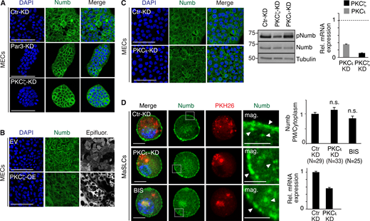 Additional data to Fig. 1. (A and B) Numb confocal immunofluorescence in mouse MECs stably silenced for Par3 (Par3-KD) and PKCζ (PKCζ -KD) or mock silenced (Ctr-KD; A) or overexpressing Venus (EV) and PKCζ-Venus (PKCζ -OE; B). Numb (green, pseudocolored from Cy3 staining), epifluorescence (gray, pseudocolored from Venus, in EV, and PKCζ-Venus, in PKCζ -OE), DAPI (blue). Bars, 100 µm. (C) Left: Numb confocal immunofluorescence in mouse MECs stably silenced for PKCι (PKCι-KD). Numb (green), DAPI (blue). Bar, 100 µm. Middle: Immunoblots of Numb and pNumb in the cell lysates indicated on top. Tubulin, loading control. Right: qPCR analysis showing the efficacy of PKCι and PKCζ silencing in MaSLCs. Data are expressed relative to control cells (dashed line). (D) Numb confocal immunofluorescence. Left: MaSLCs (PKH26POS cells) from WT mammospheres (MS) stably silenced for PKCι (PKCι-KD), were stained with anti-Numb and DAPI. Control cells were also treated with 3 μm Bisindolylmaleimide I (BIS) o/n and subjected to the same IF. The boxed areas are magnified on the right. PHK26 (red), Numb (green), DAPI (blue). Bar, 10 μm. Mag, magnification (bar, 3 μm). White arrows in magnifications point to PM or cytoplasmic areas. Right (top), quantitation of the experiment. Data are expressed as ratio between plasma membrane (PM) and cytoplasmic Numb, relative to control (N, number of cells analyzed). Right (bottom), qPCR analysis showing the efficacy of PKCι silencing in MaSLCs. Data are expressed relative to control cells ± SE; statistical analysis was with the Student’s t test two-tailed. In this and all subsequent supplementary figures: P is: *, <0.05; **, <0.01; ***, <0.001. Source data are available for this figure: SourceData FS1. Refer to the image caption for details.