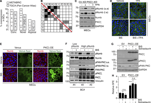 Additional data to Fig. 9. (A and B) Overexpression of PKC isoforms in human breast cancers. (A) The overexpression of PKC isoforms was evaluated in the METABRIC and TGCA (Pan Cancer Atlas) BC datasets, as described in Materials and methods. Parameters used were: mRNA expression z-scores relative to all samples (log microarray); z-score threshold + 2.0. The percentage of alterations in the two datasets (METABRIC, N = 1904; TGCA, N = 994) is reported for the three classes of PKCs and further subdivided for each gene (A, PRKCA or α; B, PRKCB or β; G, PRKCG or γ; D, PRKCD or δ; E, PRKCE or ε; H, PRKCH or η; Q, PRKCQ or θ; Z, PRKCZ or ζ; I, PRKCI or ι). (B) Matrix showing the co-occurrence of overexpression of PKC isoforms. The matrix shows the co-occurrence (P < 0.05 by one-tailed Fisher’s exact test). Color code: black, co-occurrence in both datasets (METABRIC and TGCA); gray, co-occurrence in only one dataset. (C–H) Various controls for the specificity of the effects of TPA and of PKC inhibitors. (C) The indicated MEC transfectants were stimulated with TPA (1 μM for 12′) followed by IB with the indicated Ab. GAPDH is a loading control. S.e, short exposure; l.e, long exposure. The blot shows that also in the absence of PKCζ, TPA can efficiently phosphorylate Numb. (D) Numb confocal immunofluorescence in mouse MECs treated with TPA (1 μM TPA, 12 min), BIS (3 μM, 6 h) or a combination of TPA + BIS. In the combination treatment, cells were pretreated with BIS for 6 hr and then induced with TPA for 1 μM TPA for 12 min. Numb (green), DAPI (blue). Bar, 100 µm. (E) Numb confocal immunofluorescence in mouse MECs stably overexpressing Venus (Venus) or PKCζ-Venus (PKCζ -OE) treated with BIS (3 μM, 6 h). Numb (red), epifluorescence (Venus), DAPI (blue). Bars, 100 µm. (F) The indicated BC cultures were treated or not with BIS (3 μM o/n) and immunoblotted as shown on the right. Vinculin, loading control; l.e., long exposure. The figure shows that in BC displaying high pNumb, BIS significantly reduces the level of pNumb. (G) MS from WT mice were dispersed and infected with Venus (EV) or PKCζ-Venus (PKCζ -OE), and treated with BIS (3 μM o/n) or Sotrastaurin (0.5 μM o/n), another PKC inhibitor (Albert et al., 2022) and subjected to IB as indicated. (H) Cells as in G were treated with BIS (3 μM for the duration of the experiment) or Sotrastaurin (0.5 μM for the duration of the experiment), and subjected to a MS assay, as indicated. Data are expressed relative to control (EV untreated) cells ± SD (see also Table S2). Statistical analysis was with the Student’s t test two-tailed. The combined results of G and H show that treatment with two different PKC inhibitors cannot revert the biochemical and biological effects of PKCζ -OE. Source data are available for this figure: SourceData FS5. Refer to the image caption for details.