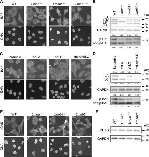 Effect of lamin depletion on localization of BAF and cGAS. (A and B) The localization and phosphorylation of BAF in WT, Lmna−/−, Lmnb1−/−, and Lmnb2−/− MEFs was analyzed by immunofluorescence (A) and immunoblotting, respectively (B). (A) Single confocal sections of the indicated cells stained with anti-BANF1/BAF (EPR7668), followed with Alexa Fluor 488-labeled anti-rabbit IgG, and Hoechst 33342 for DNA. (B) Whole cell lysates from the indicated cells were probed with anti-LA/C, anti-LB1/2, anti-GAPDH (as loading control), and anti-BANF1/BAF (EPR7668). (C and D) The localization and phosphorylation of BAF in WT MEFs expressing scrambled control, shLA, shLC or a combination of shLA and shLC was analyzed by immunofluorescence (C) and immunoblotting, respectively (D). (C) Single confocal sections of the indicated cells stained with anti-BANF1/BAF (EPR7668), followed with Cy5-labeled anti-rabbit IgG, and Hoechst 33342 for DNA. (D) Whole cell lysates from the indicated cells were probed with anti-LA/C, anti-GAPDH (as loading control), and anti-BANF1/BAF (EPR7668). (E and F) The localization and the expression levels of cGAS in WT, Lmna−/−, Lmnb1−/−, and Lmnb2−/− MEFs was analyzed by immunofluorescence (E) and immunoblotting, respectively (F). (E) Single confocal sections of the indicated cells stained with anti-cGAS, followed with Alexa 488-labeled anti-rabbit IgG, and Hoechst 33342 for DNA. (F) Whole cell lysates from the indicated cells were probed with anti-cGAS and anti-GAPDH (as loading control). (A–F) At least two independent experiments were performed. (A, C, and E) Bars: 20 μm. (B, D, and F) Positions of the size standards are shown on the right. The values on non-phospho-BAF, phospho-BAF and LA/C are densitometric quantitation normalized to GAPDH. Source data are available for this figure: SourceData F6. Refer to the image caption for details.