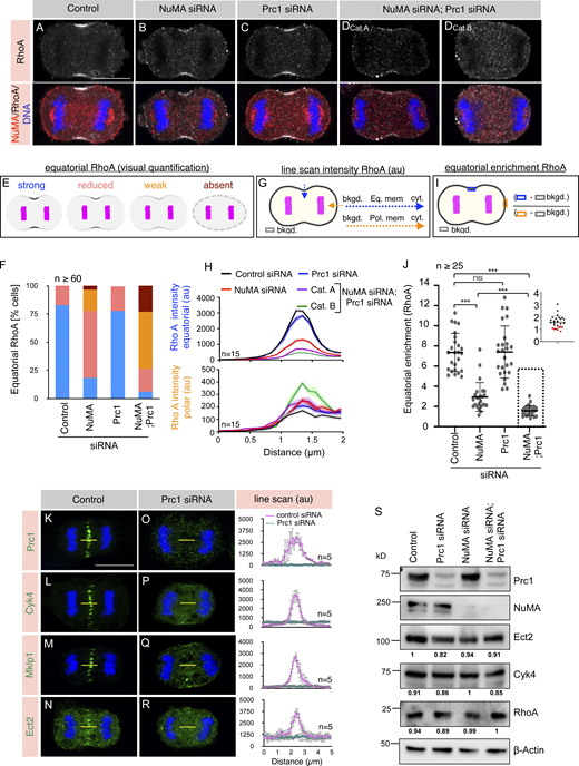 NuMA and Prc1 co-depletion impact RhoA accumulation at the equatorial membrane. (A–D) IF analysis of HeLa Kyoto cells that are either transfected with control siRNA (A) or siRNA-against NuMA (B), Prc1 (C), or Prc1 and NuMA (DCat.A and DCat.B). Cells were fixed 60 h post siRNA transfection and stained with anti-RhoA (gray) and anti-NuMA (red) antibodies. A minimum of 60 cells from three independent experiments were visually analyzed for RhoA based on their interchromatid distance during anaphase and representative images are shown in the Figure panel. The relative frequency of these category are mentioned in F. Note that NuMA and Prc1 co-depleted cells either show weak (Cat. A) or no RhoA (Cat. B) enrichment at the equatorial membrane. Also, note that Cat. B cells do not show cytokinetic furrow despite significant inter chromatid distance. In Prc1 depleted cells, in addition to its usual membrane localization, NuMA mislocalizes next to the DNA, possibly because of the absence of an intact spindle midzone. The scale bar in the panel and following panels represent 10 μm. (E and F) Schematic representation of the visual quantification of equatorial RhoA membrane intensity (E), and the % of cells based on such visual quantification in various siRNA transfected conditions (F). For such analysis, cells were grouped into four categories: strong (depicted in blue), as in control siRNA transfected cells, reduced (depicted in pink), as in NuMA siRNA, weak (depicted in orange) as in NuMA and Prc1 siRNA Cat. A, and absent (depicted in brown) as in NuMA and Prc1 siRNA Cat. B. (n = 109 cells for control siRNA; n = 81 cells for NuMA siRNA; n = 96 cells for Prc1 siRNA, and n = 60 cells for NuMA and Prc1 siRNA transfected cells from three independent experiments). (G and H) Schematic representation of line scan analysis (G) and the outcome (H) of this analysis for Rho A intensity at the equatorial membrane (depicted in blue) and polar membrane (shown in orange) in different siRNA transfected conditions. Please note a decrease in RhoA equatorial intensity in NuMA siRNA (P < 0.0001) as well as NuMA and Prc1 siRNA (P < 0.0001) transfected cells. Also, note a marginal increase in RhoA intensity at the polar membrane surface in cells transfected with either NuMA siRNA (P = 0.0018) or NuMA and Prc1 siRNA (Cat A: P < 0.04; Cat B: P < 0.0001). The RhoA intensity in Prc1 depleted cells at the polar membrane is non-significant (P = 0.108). n = 15 representative cells from all siRNA conditions were used for this quantification; the shaded region indicates SEM; the intensity value at the peak of each line scan curve has been compared to that of control to measure the P value by two-tailed unpaired Student’s t test. (I and J) Schematic representation of the quantification method (I), and the outcome of such analysis for equatorial membrane enrichment of RhoA fluorescence intensity (J). Please note a significant decrease in equatorial membrane RhoA intensity in cells depleted for NuMA, or NuMA and Prc1. The distribution for the RhoA intensity for all the cells depleted for NuMA and Prc1 is shown in the inset. Note that ∼30% of cells show the ratio of a selected region at the equatorial membrane to that of a similar area at the polar membrane is ∼1 (shown as red dots in the inset). ns, P > 0.05; ***, P < 0.001 as determined by two-tailed unpaired Student’s t test. n = 25 cells for control siRNA, NuMA siRNA, or Prc1 siRNA, and n = 27 cells for NuMA and Prc1 siRNA transfected cells were taken from three independent experiments; error bars: SD. (K–R) IF analysis of the central spindle localization of Prc1 (K and O), Cyk4 (L and P), Mklp1 (M and Q), or Ect2 (N and R) in HeLa Kyoto cells that are transfected with either control siRNA or siRNA against Prc1. Yellow-line represents the area that was used for computing the line scan intensity (in the arbitrary unit, au) on the right of each panel. n = 5 cells in each condition, as depicted; error bars: SD. (S) Immunoblot analysis of mitotically synchronized protein extracts made from HeLa Kyoto cells that were either transfected with control siRNA or siRNA against Prc1, NuMA, or Prc1 and NuMA for 60 h. The resulting blot was probed with anti-NuMA, Anti-Prc1, anti-Ect2, anti-Cyk4, and anti-RhoA antibodies. Anti-β-actin antibodies were used to analyze the equal loading of the samples. The values below the Ect2, Cyk4, and RhoA represent the band intensity, normalized to the intensity value from the respective β-actin control. Please note that we have run various % of SDS-PAGE to detect proteins with distinct molecular weight (MW). For instance, NuMA (MW ∼238kD) is detected by running a 6% gel, and for RhoA (MW ∼22 kD) detection, we have run the samples on 12% gel. Source data are available for this figure: SourceData F7. Refer to the image caption for details.