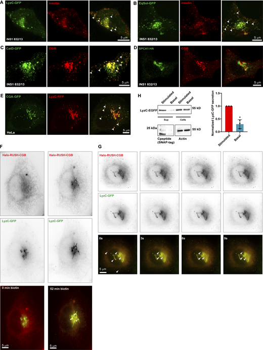 Ectopic expression of soluble secreted proteins in INS1 832/13 cells results in their routing to insulin granules. (A and B) Representative images from INS1 832/13 cells expressing LyzC-GFP (A; green) or EqSol-GFP (B; green) and stained with insulin antibody (red) to observe the localization of the ectopically expressed proteins with respect to insulin granules. Images are average projections from two slices from a confocal stack. Arrowheads point to cytoplasmic insulin granules which also shows the presence of LyzC-GFP and EqSOL-GFP respectively, in E and F. (C) Representative images from INS1 832/13 cells stably expressing CatD-GFP (green) and labeled with CGB antibody to observe the localization of ectopically expressed CatD-GFP with respect to SGs. Images are average projections from two slices from a confocal stack. Arrowheads point to some of the cytoplasmic SG, which shows colocalization of CGB and CatD-GFP. (D) Representative images from INS1 832/13 expressing HA-tagged version of the calcium ATPase, SPCA1 (green) and stained using CGB antibody (red). Images are a single slice from a confocal stack. Note that overexpressed SPCA1 remains localized at the Golgi apparatus with no signal seen from the CGB containing SGs. (E) Representative images from HeLa cells stably expressing CGA-GFP and transfected with LyzC-RFP. Images are a single slice from a confocal stack imaged in the airy-scan mode. The arrowheads point to some of the ectopic granule-like structures seen in HeLa cells upon expression of CGA-GFP. Note that LyzC-RFP gets routed to these ectopic granule-like structures. (F) Images extracted from live imaging of HeLa cells co-expressing Halo-RUSH-CGB (red) and LyzC-GFP (green) before and after addition of biotin for 52 min when CGB appears at the Golgi. (G) Images extracted from live imaging of HeLa cells co-expressing RUSH-CGB (red) and LyzC-GFP (green) after biotin addition and images after arrival of CGB at the Golgi. Arrow heads point to colocalizing structures at the Golgi and vesicles in the cytoplasm. (H) Western blot at the top shows bands for LyzC-GFP, probed using α-GFP antibody, in supernatant and lysates from INS1 832/13 cells stable expressing SNAP-tagged proinsulin. The basal condition represents cells grown in 3 mM glucose in serum-free medium and the stimulated condition represents cells grown in 15 mM glucose in serum-free medium, also containing 35 mM potassium chloride. Note the stronger band intensity in the supernatant in stimulated condition compared to the basal condition, although the levels in cell lysates are the same. The blot in the bottom left detects the presence of SNAP-tagged C-peptide, probed using α-SNAP-tag antibody, which is used as a proxy to measure insulin secretion. Again, the signal intensity of the band is stronger in stimulated condition as compared to the basal condition. The blot on the bottom right depicts actin bands in cell lysates obtained from basal and stimulated conditions. The graph quantifies secretion of LyzC-GFP normalized with levels in cell lysates in basal and stimulated conditions. Value of the band intensity in secreted compared to the band intensity in cell lysates was set to 1 for stimulated condition in each experiment. Data is represented as mean ± SD from three independent experiments. Statistical analysis was performed by two-tailed one-sample t test *P = 0.019. Source data are available for this figure: SourceData F4.