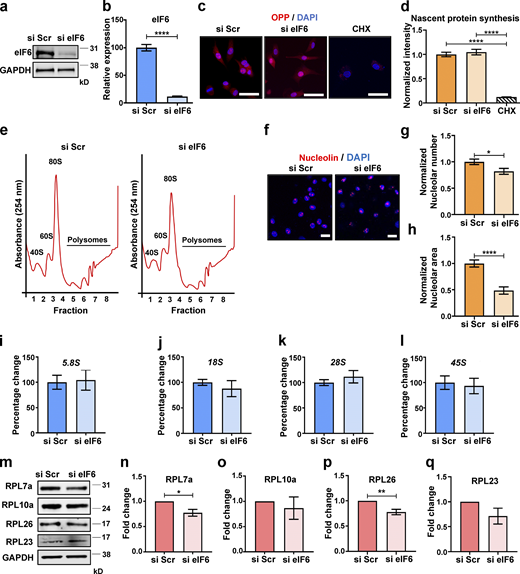 Depletion of endogenous eIF6 does not affect basal levels of protein synthesis or ribosome biogenesis. (a and b) Representative Western blot of si Scr– or si eIF6–transfected ECs and quantification of knockdown efficiency (n = 4). (c) Representative fluorescent micrographs of si Scr– or si eIF6–transfected ECs, or cycloheximide (CHX)-treated ECs following incorporation of OPP to label nascent proteins (red) using a Click-iT assay and costaining of cell nuclei (DAPI; blue). Scale bars = 20 μm. (d) Quantification of cell fluorescence following OPP incorporation Click-iT assay (n > 30 cells across three separate experiments). (e) Representative polysome profiles from si Scr and si eIF6 A431 cells after sucrose gradient fractionation, showing the small ribosomal subunit (40S), the large ribosomal subunit (60S), and the monoribosome (80S; n = 3). (f) Representative immunofluorescent micrographs of si Scr and si eIF6 ECs showing nucleolin (red) and cell nuclei (DAPI; blue). Scale bars = 20 μm. (g and h) Quantification of nucleolar frequency per cell (g) and nucleolar area (h; n > 30 and n > 60, respectively, across three separate experiments). (i–l) Quantification of pre-rRNA by qPCR in si Scr– and si eIF6–transfected ECs relative to GAPDH (n > 3): 5.8S rRNA (i), 18S rRNA (j), 28S rRNA (k), and 45S rRNA (l). (m–q) Quantification of ribosomal protein expression in si Scr– and si eIF6–transfected ECs, representative Western blots (m) and band intensity quantification of RPL7a (n), RPL10a (o), RPL26 (p), and RPL23 (q; n > 3). Values in b, d, g–l, and n–q are mean ± SEM, and significance was determined by two-sided t test. *, P < 0.05; **, P < 0.01; ****, P < 0.0001. Source data are available for this figure: SourceData F1. Refer to the image caption for details.