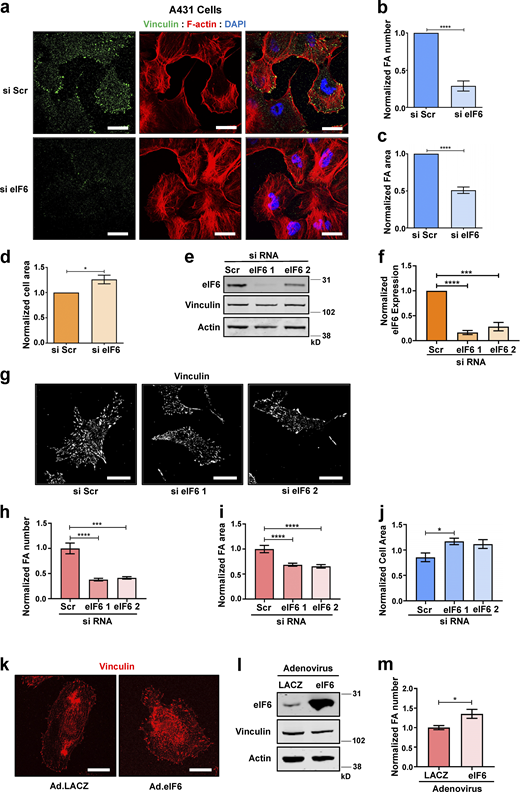 eIF6 regulates focal adhesions. (a–d) A431 cells were transfected with si Scr or si eIF6. (a) Representative immunofluorescent micrographs of cells showing focal adhesions (vinculin; green), filamentous actin (phalloidin; red), and nuclei (DAPI; blue). Scale bars = 20 μm. (b and c) Quantification of mean frequency of focal adhesions per cell (b) and focal adhesion area (c; n > 30 cells across three separate experiments). (d) Quantification of cell area (n > 30 cells across three separate experiments). (e–j) ECs were transfected with si Scr or one of two individual eIF6 siRNAs (si eIF6 1 and si eIF6 2). (e and f) Representative Western blot for eIF6 protein levels (e) and quantification of Western blot band intensities (f; n = 3). (g) Representative immunofluorescent micrographs showing vinculin-positive focal adhesions (white) in si Scr, si eIF6 1, and si eIF6 2 cells. Scale bars = 20 μm. (h and i) Quantification of mean frequency per cell (h) and mean area (i) of vinculin-positive focal adhesions (n >30 cells across three separate experiments). (j) Quantification of mean cell area (n > 30 cells across three separate experiments). (k–m) ECs were transduced with control adenovirus (Ad.LACZ) or an eIF6-expressing adenovirus (Ad.eIF6). (k) Representative immunofluorescent micrographs showing vinculin-positive focal adhesions (red). Scale bars = 20 μm. (l) Representative Western blot for eIF6 protein level (n = 5). (m) Quantification of mean frequency of vinculin-positive focal adhesions per cell (n > 30 cells across three separate experiments). Values in b–d, f, h–j, and m are mean ± SEM, and significance was determined by two-way t test; *, P < 0.05; ***, P < 0.001; ****, P < 0.0001. FA, focal adhesion. Source data are available for this figure: SourceData FS2.