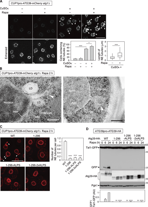 Atg39 accumulation in the NE causes NE tubulation depending on the APHs. (A)atg1Δ cells overexpressing Atg39-mCherry under the CUP1 promoter were grown in the presence or absence of 250 µM CuSO4 overnight and treated with rapamycin for 2 h. The images are maximum-intensity projections of Z stacks. The percentage of cells containing NE tubules (left) and length of NE tubules (right) are shown. Bars represent means ± SD (n = 3). *, P < 0.05; ****, P < 0.0001 (Tukey’s multiple comparisons test; left). ****, P < 0.0001 (unpaired two-tailed Mann–Whitney U test; right). (B)atg1Δ cells overexpressing Atg39-mCherry under the CUP1 promoter were treated with rapamycin for 2 h, and the nuclear morphology of these cells was examined by EM. Arrowheads, NE tubules with swollen tips. LD, lipid droplet. (C) mCherry-fused Atg39, Atg391–296, Atg391–296-ALPS, and Atg391–296-2×ALPS were overexpressed under the CUP1 promoter in atg1Δ cells. These cells were treated with rapamycin for 2 h, and the formation of NE tubules was analyzed by fluorescence microscopy. Arrowheads, NE tubules. Bars represent means ± SD (n = 3). ****, P < 0.0001 (unpaired two-tailed Student’s t test). (D) Plasmids for expressing HA-fused Atg39, Atg391–296, Atg391–296-ALPS, and Atg391–296-2×ALPS from their own promoter were integrated into the genome of atg39Δ cells. Degradation of Tal1-GFP in these cells was analyzed by immunoblotting. Pgk1 serves as a loading control. Bars represent means ± SD (n = 3). **, P < 0.01; ****, P < 0.0001 (unpaired two-tailed Student’s t test). Scale bars, 5 µm (A and C) and 200 nm (B). AU, arbitrary unit. Source data are available for this figure: SourceData F5. Refer to the image caption for details.