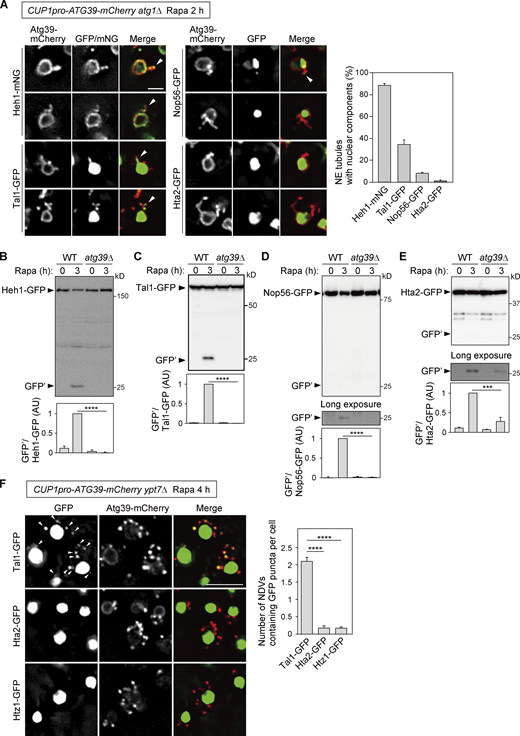 NE tubules and NDVs exclude chromosomes. (A) NE tubule formation was induced by the overexpression of Atg39-mCherry under the CUP1 promoter in atg1Δ cells, followed by rapamycin treatment for 2 h. The colocalization of Atg39-mCherry–positive NE tubules with mNG or GFP-fused Heh (INM), Tal1 (nucleoplasm), Nop56 (nucleolus), and Hta2 (histone) was examined by fluorescence microscopy. Arrowheads, NE tubules containing mNG/GFP signals. The percentage of NE tubules containing nuclear components is shown in the graph. Bars represent means ± SD (n = 3). (B–E) Degradation of GFP-fused Heh1, Tal1, Nop56, and Hta2 was examined in cells overexpressing Atg39-mCherry under the CUP1 promoter. Bars represent means ± SD (n = 3). ***, P < 0.001; ****, P < 0.0001 (unpaired two-tailed Student’s t test). (F)ypt7Δ cells overexpressing Atg39-mCherry under the CUP1 promoter were treated with rapamycin for 4 h to induce NDV accumulation. Arrowheads, puncta of Tal1-GFP that colocalized with those of Atg39-mCherry. Bars represent means ± SD (n = 3). ****, P < 0.0001 (unpaired two-tailed Student’s t test). Scale bars, 2 µm (A) and 5 µm (F). AU, arbitrary unit. Source data are available for this figure: SourceData F6.