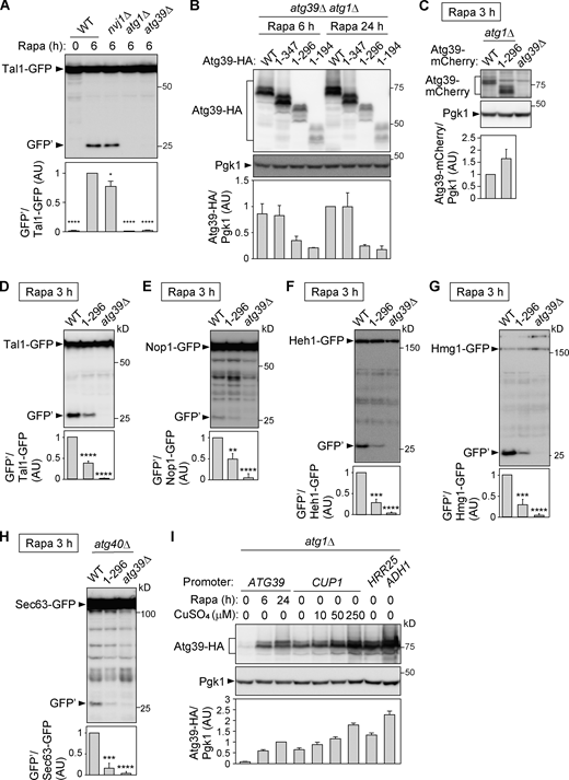 The APHs of Atg39 are required for degradation of proteins localized to different nuclear compartments. (A) Degradation of Tal1-GFP in cells lacking NVJ1 (essential for micronucleophagy), ATG1 (essential for macroautophagy), or ATG39 was analyzed by immunoblotting using anti-GFP antibody. Bars represent means ± SD (n = 3). *, P < 0.05; ****, P < 0.0001 (unpaired two-tailed Student’s t test). (B)atg39Δ atg1Δ cells carrying plasmids for expressing Atg39-HA under its own promoter were treated with rapamycin. Expression levels of Atg39-HA were analyzed by immunoblotting using anti-HA antibody. Pgk1 serves as a loading control. Bars represent means ± SD (n = 3). (C)atg1Δ cells expressing Atg39-mCherry or Atg391–296-mCherry under the CUP1 promoter were grown in the presence of 50 or 100 µM CuSO4, respectively, and treated with rapamycin for 3 h. Bars represent means ± SD (n = 3). (D–H) Degradation GFP-fused Tal1 (nucleoplasm), Nop1 (nucleolus), Heh1 (INM), Hmg1 (ONM), and Sec63 (ER) were analyzed by immunoblotting. Cells were grown and harvested under the same conditions as in C. Bars represent means ± SD (n = 3). **, P < 0.01; ***, P < 0.001; ****, P < 0.0001 (unpaired two-tailed Student’s t test). (I) Expression levels of Atg39-HA under the control of different promoters used in this study and in media containing different concentrations of CuSO4 were compared. Bars represent means ± SD (n = 3). AU, arbitrary unit. Source data are available for this figure: SourceData FS2.