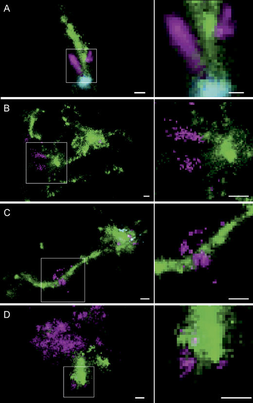 Multicolor SMLM suggests endosomal mRNA escape at the nanoscale from transferrin-containing tubules in primary human adipocytes and HeLa cells. Exemplary images of the different observable types of Cy5-mRNA (magenta) escape in primary human adipocytes and HeLa cells relative to transferrin-positive tubules (green) and EGF (cyan). (A) Concentrated mRNA signal is located at the very tip of a transferrin-positive tubule, connected to an elongated mRNA signal colocalizing along the tubule. Very sparse mRNA signal can be detected outside the tubule. (B) Disperse Cy5-mRNA is seemingly emanating from the transferrin-positive tubule from which it is already segregated. These patterns clearly do not constitute intact LNP and are likely to represent partly stretched mRNA molecules escaping from endosomal structures. (C) An LNP is located on a long transferrin-positive tubule together with a perpendicular dispersed Cy5-mRNA signal, likely representing an instance of Cy5-mRNA escape. (D) In very rare cases, also in arrested endosomes (compare Fig. 4), dispersed mRNA signal attached to a transferrin-positive structure can be detected. ROIs indicating the cellular context of displayed endosomes are provided in Supplemental figures, Figs. S15, S17, S18, S19, S20, S21, S22, S23, S24, S25, and S26. Zoom-in of the indicated regions are presented in the right-side panels. Scale bars are 100 nm.
