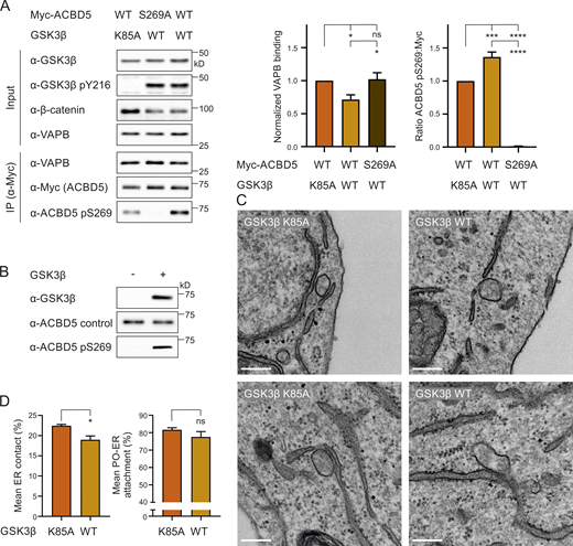 GSK3β modulates the ACBD5–VAPB interaction via S269.(A) GSK3β (K85A) was coexpressed with Myc-ACBD5 WT or S269A in COS-7 cells. Myc-ACBD5 was immunoprecipitated, and endogenous bound VAPB was detected by immunoblotting using Myc/VAPB antibodies. VAPB (IP fraction) was normalized against total VAPB (input) and Myc-ACBD5 (IP fraction). Phosphorylation of ACBD5 S269 (pS269) was detected by immunoblotting using ACBD5 pS269/Myc antibodies. GSK3β catalytic (in)activity was confirmed using GSK3β/GSK3β pY216/β-catenin antibodies. Data were analyzed by one-way ANOVA with Tukey’s multiple comparisons test (n = 4). (B) Recombinant His-ACBD5 was incubated in the absence or presence of recombinant GST-GSK3β. Phosphorylation of ACBD5 at S269 was examined by immunoblotting using ACBD5 pS269/ACBD5 control antibodies. (C) Representative electron micrographs of peroxisome–ER contacts in COS-7 cells transfected with a catalytically inactive GSK3β (GSK3β K85A) or GSK3β WT. (D) Assessment of the mean peroxisome membrane surface in direct contact with the ER. Quantitative analysis of the mean population of peroxisomes associated with the ER. Data were analyzed by a two-tailed unpaired t test. Results of four grids per condition. *, P < 0.05; ***, P < 0.001; ****, P < 0.0001. Bars: 200 nm. Source data are available for this figure: SourceData F7.