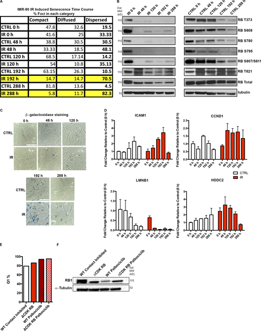 RB activation in irradiated or palbociclib treated cells. (A) Percentage of foci classified into different categories of skeleton dot lengths in IMR-90 cells from the experiment described in Fig. 3 D. Highlighted rows show time points at which a major increase in dispersion was observed. CTRL, control. (B) The changes in RB phosphorylation during IR-induced senescence in IMR-90 cells. Western blots show a major and prolonged loss of RB phosphorylation at all the tested sites, observed first 48 h after IR treatment and through the time course for IR-treated cells. Nontreated cells show reduction in some RB phosphorylation forms at later time points (192 and 288 h) owing to contact inhibition–induced G1 arrest but retain overall phosphorylation. MW, molecular weight. (C) β-Galactosidase staining of the same populations of cells. Scale bar = 190 µm. (D) Changes in expression of key IR-induced senescence signature genes over the time course in IMR-90 cells. Four genes, ICAM1, CCND1, LMNB1 and HDDC2, show dynamic changes as the cells progress toward senescence. Graphs show fold-changes (enrichment over 0-h time point) for the four genes in CTRL (untreated) and IR-treated samples. Three technical replicates per sample were used to calculate fold-changes. (E) Percentage of G1 cells for WT RPE contact-inhibited cells, ΔCDK-RB cells, and both treated with palbociclib for 72 h. (F) Western blot analysis of the cells in E with the indicated antibodies. Note the presence of only the unphosphorylated RB form (lower molecular weight band) in ΔCDK-RB, palbociclib-treated WT, and ΔCDK-RB samples. Source data are available for this figure: SourceData FS1.