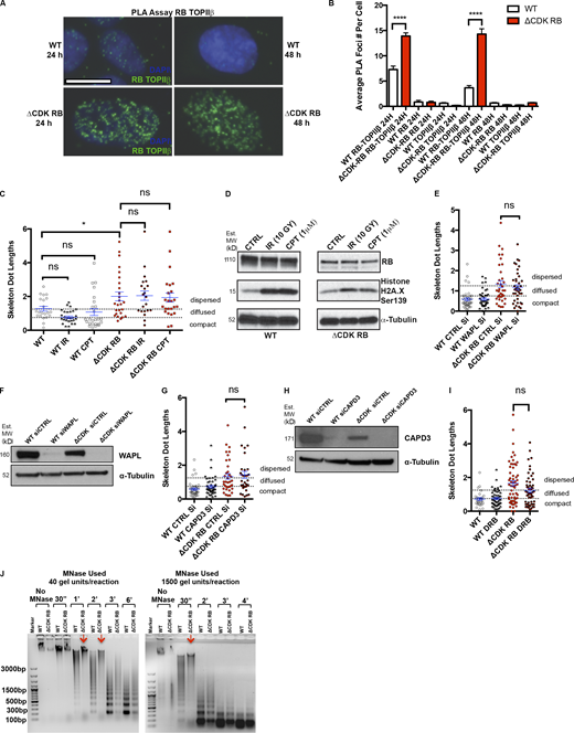 Investigation of the role of DNA damage, WAPL, and CAPD3 in RB-mediated dispersion. RB activation increases chromatin resistance to MNase digestion. (A) PLA images for WT and ΔCDK-RB after 24 and 48 h of DOX induction. Just 24 h of ΔCDK-RB expression leads to higher RB-TOPIIβ PLA interaction foci, when compared with WT cells. A similar increase was observed after 48 h of ΔCDK-RB induction. Images show G1 cells. (B) Average numbers of RB-TOPIIβ PLA foci per G1 cell were higher for ΔCDK-RB after 24 and 48 h of DOX induction, when compared with WT. Negative controls (using only RB or TOPIIβ antibody for PLA assay) showed low average numbers of PLA foci in both WT and ΔCDK-RB cells, implying that there was very little background signal. Numbers of foci quantified for each sample (n) are as follows: n = 95 (WT, RB-TOPIIβ 24 h), 214 (ΔCDK-RB, RB-TOPIIβ 24 h), 29 (WT, RB 24 h), 83 (ΔCDK-RB, RB 24 h), 70 (WT, TOPIIβ 24 h), 74 (ΔCDK-RB, TOPIIβ 24 h), 80 (WT, RB-TOPIIβ 48 h), 162 (ΔCDK-RB, RB-TOPIIβ 48 h), 69 (WT, RB 48 h), 110 (ΔCDK-RB, RB 48 h), 70 (WT, TOPIIβ 48 h), 130 (ΔCDK-RB, TOPIIβ 48 h). Error bars show SEM. Nonparametric two-tailed Mann–Whitney U test was performed for pairs of samples indicated on the graph, and asterisks denote P values. (C) Mean skeleton dot lengths (chromosome 7 α-satellite probe) after WT and ΔCDK-RB RPE cells were treated with IR or camptothecin (CPT) to induce DNA damage. Numbers of foci quantified for each sample (n) are as follows (in the order they appear on the bar graphs): n = 21, 28, 25, 26, 21, 24. Error bars are SEM. One-way ANOVA and Holm–Sidak multiple comparison tests were performed, and asterisks denote P values. (D) Western blot analysis of cells in C show that IR and CPT induced H2A.X Ser139 phosphorylation in both WT and ΔCDK-RB–expressing cells. Note that IR- or CPT-induced DNA damage does not affect the ΔCDK-RB–induced chromatin dispersion. MW, molecular weight. (E, G, and I) Mean skeleton dot lengths (chromosome 7 α-satellite probe) after WT and ΔCDK-RB RPE cells were treated with control and CAPD3 siRNAs (E), control and WAPL siRNAs (G), or DMSO and DRB (I). Note that none of these treatments significantly modified dispersion levels in either WT or ΔCDK-RB–expressing RPE cells. Numbers of foci quantified for each sample (n) are as follows (in the order they appear on the bar graphs): E, n = 40, 41, 36, 39; G, n = 40, 47, 36, 34; I, n = 29, 51, 58, 53. Error bars are SEM. For E, G, and I, nonparametric two-tailed Mann–Whitney U test was performed for pairs of samples indicated on the graphs, and asterisks denote P values. ns, P > 0.05; *, P ≤ 0.05; ****, P ≤ 0.0001. (F and H) Western blots for WT and ΔCDK-RB cells treated with control and WAPL siRNAs (F) and control and CAPD3 siRNAs (H). (J) MNase digestion profile of WT and ΔCDK-RB samples. Left: MNase digestion profile for WT and ΔCDK-RB nuclei treated with 40 gel units of MNase per reaction. Right: MNase digestion profile for WT and ΔCDK-RB cells treated with 1,500 units of MNase per reaction. All other conditions were the same. Note: WT samples resolve into a ladder-like typical MNase digestion pattern as early as 30 s at higher MNase concentrations and 1 min at lower concentrations. The ΔCDK-RB sample does not digest into a ladder-like pattern at 30 s at higher MNase concentrations and at even 1 min at lower concentrations (red arrows). A clear MNase digestion ladder is seen at 3 min (left gel) and 2 min (right gel) in the ΔCDK-RB samples, much later than the laddering in WT cells. 1 µg DNA was loaded per well. DNA samples were run on 0.8% agarose gel. Dashed lines indicate the cutoffs for defining the categories compact, diffused, and dispersed for chromosome 7 α-satellite. Source data are available for this figure: SourceData FS4. Refer to the image caption for details.