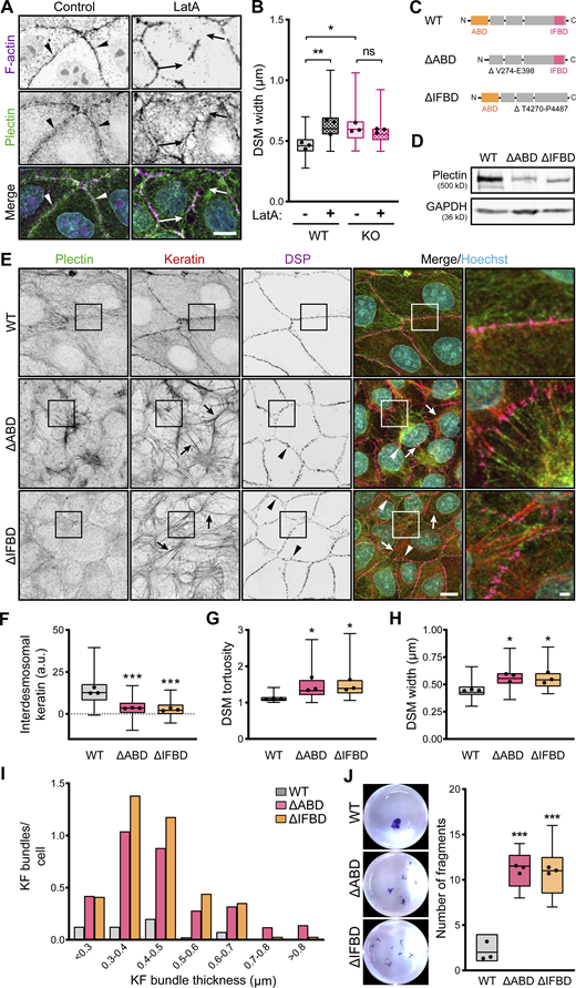 Intact KF–DSM networks require plectin interaction with both F-actin and KFs. (A) Representative confocal images of untreated (Control) and LatA-treated (1 μM, 30 min) WT MDCK monolayers stained for plectin (green) and F-actin (magenta). Nuclei, Hoechst (cyan). Arrowheads, regions of plectin and cortical F-actin colocalization; arrows, regions of depolymerized cortical F-actin. Note relocalization of plectin from the plasma membrane in the absence of cortical F-actin. Scale bar, 10 μm. (B) Quantification of DSM widths from indicated WT and KO monolayers shown in A. Boxplots show the median, 25th, and 75th percentile with whiskers reaching the last data point; dots, means of independent experiments; n = 100 (WT), 123 (WT + LatA), 114 (KO), and 109 (KO + LatA) DSMs; N = 3. One-way ANOVA Tukey’s multiple comparison test; *, P < 0.05; **, P < 0.01; ns, P > 0.05. (C) Schematic of CRISPR/Cas9-engineered deletions between amino acid residues V274-E398 or T4270-P4487 (Uniprot accession no. F1PHS5), corresponding to actin (∆ABD; orange) and the IF (∆IFBD; pink) binding domains (for details, see Fig. S4 A and Materials and methods section). (D) Immunoblot analysis of mutated MDCK clones harboring ∆ABD and ∆IFBD deletion. GAPDH, loading control. (E) Representative confocal images of WT, ∆ABD, and ∆IFBD monolayers immunolabeled for plectin (green), keratin (red), and DSP (magenta). The same images are also presented in Fig. S4. Arrows, thick keratin bundles; arrowheads, misshaped DSMs. Boxed areas, ×2 images. Scale bar, 10 and 3 μm (boxed areas). (F–H) Quantification of interdesmosomal keratin fluorescence intensity (F), DSM tortuosity (G) and widths (H) from SIM (F and G) and confocal (H) images of WT, ∆ABD, and ∆IFBD monolayers. Boxplots show the median, 25th, and 75th percentile with whiskers reaching the last data point; dots, means of independent experiments; n (F) = 142 (WT), 94 (∆ABD), and 99 (∆IFBD) interdesmosomal areas; n (G) = 74 (WT), 65 (∆ABD), and 70 (∆IFBD) DSMs; n (H) = 102 (WT), 102 (∆ABD), and 93 (∆IFBD) DSMs; N = 3. One-way ANOVA Tukey’s multiple comparison test; *, P < 0.05; ***, P < 0.001. (I) Histogram of the KF bundle widths from WT, ∆ABD, and ∆IFBD monolayers. n = 40 (WT), 50 (∆ABD), and 34 (∆IFBD) cells; N = 3. (J) Fragmented WT, ∆ABD, and ∆IFBD monolayers after dispase-based mechanical dissociation assay. Boxplots show the median, 25th, and 75th percentile with whiskers reaching the last data point; dots, means of independent experiments; N = 3. One-way ANOVA Tukey’s multiple comparison test; ***, P < 0.001. Source data are available for this figure: SourceData F5.