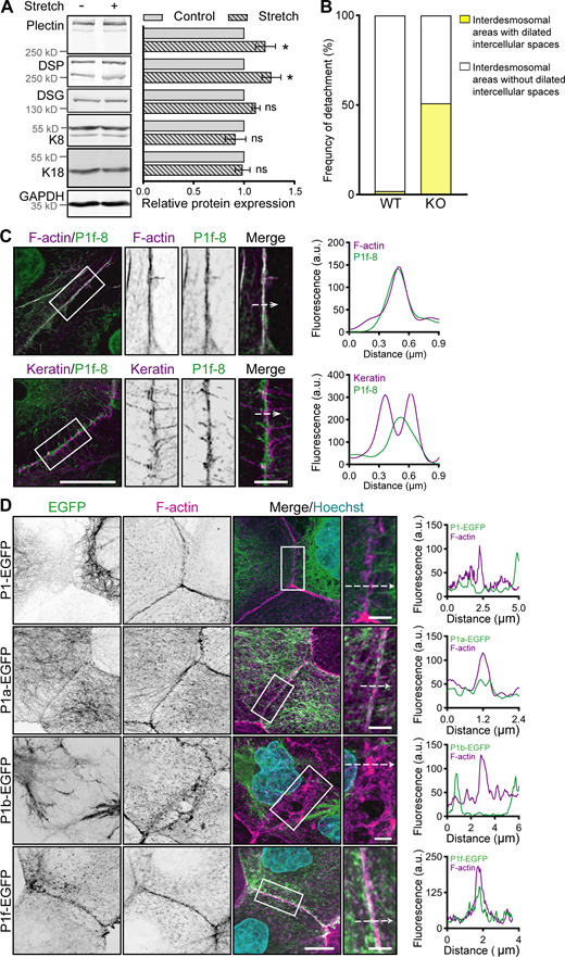 Stretch-induced changes, expression of P1f-8-EGFP and NCD treatment in cell monolayers. (A) Quantification of plectin, DSP, DSG, K8, and K18 in lysates from WT and KO MDCK monolayers by immunoblotting. GAPDH, loading control. The graph shows relative band intensities normalized to average WT values. Data are presented as mean ± SEM; N = 4. Two-tailed t test; *, P < 0.05; ns, P > 0.05. (B) Graph shows the percentage of interdesmosomal areas with dilated intercellular spaces in monolayers shown in Fig. 2 F. n = 164 (WT) and 167 (KO) interdesmosomal areas. (C) Representative STED images of peripheral F-actin (upper panel) and keratin (lower panel) structures in WT MDCK monolayers expressing EGFP-tagged plectin fragment 1f-8 (P1f-8; green) and stained for F-actin and keratin (both magenta). Dashed lines, line scans (right). Boxed areas, ×2 images. Scale bar, 10 and 3 μm (boxed areas). Graphs show line-scan analysis of P1f-8-EGFP and F-actin (upper panel) and keratin (lower panel) fluorescence intensities. (D) Representative confocal images of midsections of KO MDCK monolayers expressing indicated full-length EGFP-tagged plectin isoforms (green) and stained for F-actin (magenta). Nuclei, Hoechst (cyan). Dashed lines, line scans (right). Boxed areas, ×2 (P1b) and ×2.66 (P1, P1a, and P1f) images. Scale bars, 10 and 3 μm (boxed areas). Graphs show line-scan analysis of indicated full-length EGFP-tagged plectin isoforms and F-actin fluorescence intensities. Source data are available for this figure: SourceData FS2.