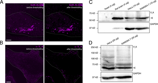 Comparison of SidK-AL568 and V1A antibody specificity. (A and B) Demonstration of the Costes thresholding method used before colocalization analyses. HeLa cells were stained with SidK-AL568 (A; magenta) or α-V1A (B; magenta), and the trans-Golgi was immunostained as described in Materials and methods. For both A and B, the left panel shows staining of the magenta channel before Costes thresholding, while the right panel shows the same channel after thresholding. Outlines of cells are indicated by dotted lines. Scale bars: 5 µm. Images in A and B correspond to Fig. 4, C and H, respectively. (C) Immunoblotting of the indicated protein amounts of yeast membranes, rat membranes, and HeLa and RAW264.7 lysates for the V-ATPase using the V1A antibody, α-ATP6V1A. The V1A band is marked with an open arrowhead. V1A blot is shown in comparison to its GAPDH loading control. (D) Immunoblotting of 20 µg protein samples of HeLa and RAW264.7 lysates with the V1A antibody. The V1A band is marked with an open arrowhead. V1A blot is shown in comparison to its GAPDH loading control. Blots in C and D are representative of three similar experiments. Source data are available for this figure: SourceData FS2. Refer to the image caption for details.