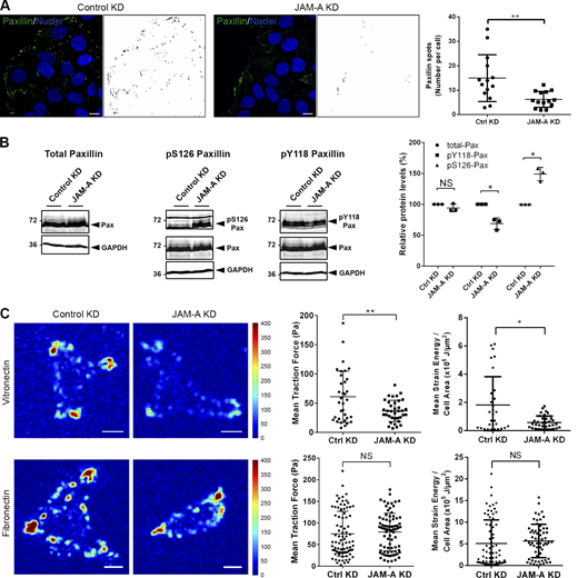 JAM-A regulates paxillin turnover, paxillin phosphorylation, and force generation at cell–matrix adhesions. (A) Confluent monolayers of MCF7 cells with inducible KD of JAM-A (pEmU6proT plasmid; − dox: shRNA off (Ctrl MCF7), + dox: shRNA on (JAM-A KD MCF7) were scratch-wounded, allowed to migrate, and stained with anti-paxillin antibodies. Paxillin-positive spots were visualized using ImageJ software and are depicted in the black-and-white pictures. Right panel: Quantification of paxillin-positive spots. Four to six randomly chosen fields of view with ∼10 cells per field of view were analyzed (n = 145 cells for control cells, n = 171 cells for JAM-A KD cells, three independent experiments). Immunofluorescence signals with a minimum size of 45 pixels were counted. Statistical analysis was performed with unpaired Student’s t test and is depicted as means ± SD. **, P < 0.01. Scale bars: 10 µm. (B) Lysates from control MCF7 cells (pLVTHM-EGFP) or JAM-A KD MCF7 cells (pLVTHM-EGFP-JAM-A-shRNA) were analyzed by Western blotting using antibodies against total paxillin (Pax), P-Ser126 paxillin (pS126Pax), or P-Tyr118 paxillin (pY118Pax). Right: Western blot signals were quantified using the Odyssey application software. Paxillin signals were corrected for loading differences using GAPDH signals and phospho-paxillin signals were normalized to the corrected paxillin signals. Signals obtained from control samples were set to 100%. Statistical analysis was performed using one-sample t test. NS, not significant; *, P < 0.05. (C) MCF7 cells stably transfected with a control vector (pLVTHM-EGFP, Control KD) or with a JAM-A shRNA expression vector (pLVTHM-EGFP-JAM-A-shRNA, JAM-A KD) were seeded subconfluently on a µ-Dish containing either VN-coated or FN-coated polyacrylamide gels of 3 kPa stiffness. Left: Traction fields of control MCF7 cells and JAM-A KD MCF7 cells on VN and FN. Traction forces are color-coded as indicated by the color bar and are depicted in Pascal (Pa). Right: Quantification of mean traction forces and mean strain energy per cell area on VN-coated PAA gels (n = 34 for Ctrl cells, n = 35 for JAM-A KD cells, four independent experiments), and FN-coated coated PAA gels (n = 74 for Ctrl cells, n = 74 for JAM-A KD cells, four independent experiments). Statistical analysis was performed using unpaired Student’s t test and is depicted as means ± SD. *, P < 0.05; **, P < 0.01. Scale bars: 10 µm. Source data are available for this figure: SourceData F6.