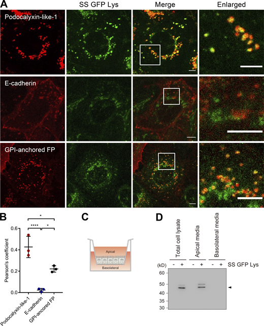 SS-GFP-Lys is transported together with podocalyxin to the apical membrane. (A) EpH4 cells stably expressing SS-GFP-Lys were transfected with one of GPI-mScarlet, E-cadherin-mCherry, or Podocalyxin-like-1-mScarlet (PODXL1-mScarlet). Living cells were observed with a confocal microscope at 37°C. GPI-mScarlet and PODXL1-mScarlet showed co-localization with SS-GFP-Lys dots, but E-cadherin-mCherry did not. Scale bar, 5 μm. (B) The degree of co-localization between SS-GFP-Lys and one of GPI-mScarlet, E-cadherin-mCherry, or PODXL1-mScarlet was analyzed by Pearson’s correlation coefficient in colocalization (ImageJ). N = 3 independent experiments; error bar, SD; ***, P = 0.0005; *, P(Podocalyxin-like-1) = 0.0143; and *, P(E-cadherin) = 0.0170 by one-way ANOVA with Tukey’s post-hoc test. (C) EpH4 cells stably expressing SS-GFP-Lys were cultured on a two-chamber filter and grown to confluence. After 48 h of culture, the medium of the apical side and that of the basolateral side were collected and concentrated 30-fold. (D) Samples obtained as in Fig. 3 C were resolved by SDS-PAGE and immunoblotted with anti-GFP mAb. Arrowhead indicates the expected molecular weight of SS-GFP-Lys. Source data are available for this figure: SourceData F3. Refer to the image caption for details.