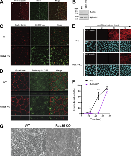 Rab35 is required for the apical transport of sphingomyelin. (A) Wild-type EpH4 cells stably expressing Scarlet-Occludin and Rab35 KO cells were cultured together and stained with anti-Rab35 antibody (Green). Scale bar, 10 µm. (B) Total cell lysate of Rab35 KO cells was resolved by SDS-PAGE and immunoblotted with anti-Rab35 mAb and anti-alpha-tubulin mAb. (C) Subcellular localization of SS-GFP-Lys expressed in wild-type EpH4 cells and Rab35 KO cells. Scale bar, 10 µm. (D) Subcellular localization of GFP-tagged podocalyxin expressed in wild-type EpH4 cells and Rab35 KO cells. Scale bar, 10 µm. (E) EpH4 wild-type (WT) cells and Rab35 KO cells were treated with bSMase. bSMase was washed out and cells were cultured in normal medium for the indicated times. Recovery of sphingomyelin at the apical membrane was evaluated by staining with RFP-Lysenin. Scale bar, 20 μm. (F) Quantification of the number of RFP-Lysenin-positive cells at the apical membrane based on E. N ≥ 12 independent experiments; error bar, SD; *, P = 0.1008; ***, P = 0.0001; and ****, P < 0.0001 by Student’s t test. (G) Scanning electron microscopy of wild-type EpH4 cells and Rab35 KO cells. Scale bar, 5 µm. Source data are available for this figure: SourceData FS5.