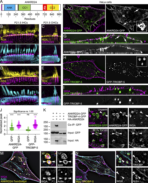 ANKRD24 self-association and association with plasma membrane and intracellular membranes. (A) Domain structure of ANKRD24. Magenta box, amino acids 1–12; ANK, ankyrin repeats (five); CC1, coiled-coil region no. 1; CC2, coiled-coil region no. 2; Ala, alanine-rich domain (overlaps with CC2). (B–E) Localization of ANKRD24 and TRIOBP relative to RDX and actin (triple-labeled samples) in IHCs and OHCs. (F–I), Localization of ANKRD24-GFP or GFP–TRIOBP-5 in unpermeabilized HeLa cells relative to WGA. Arrows in F and G indicate ANKRD24 at the plasma membrane. (J) Quantitation of membrane association (one-sample t tests; n = 60 for each). ****, P < 0.0001. (K) Coimmunoprecipitation (Co-IP) of ANKRD24-GFP with HA-ANKRD24. TRIOBP-4-GFP, which does not bind ANKRD24, included as a control. Molecular mass markers (kD) on left. (L) Localization of ANKRD24-GFP and WGA in unpermeabilized (left) and permeabilized (right) HeLa cells. WGA labeling is inside ANKRD24 whorl-like aggregates (arrowheads). (M and N) Localization of WGA binding and actin relative to ANKRD24-TwinStrepII or Myc–TRIOBP-5. WGA and actin are associated with ANKRD24, but only actin is within TRIOBP-5 aggregates (arrowheads). Panel full widths: B and D, 10 µm; C and E, 5 µm; F and H, 60 µm (insets 3 µm); G and I, 52 µm; L, 10 µm; M and N, 50 µm (panels on right, 6 µm). Superresolution modality for B–I and M–N, lattice SIM. Source data are available for this figure: SourceData F2. Refer to the image caption for details.