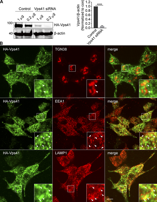 Localization of VPS41. Related to Fig. 8. (A) PC12 cells were transiently cotransfected with 1 or 0.2 µg HA-Vps41 and either control or Vps41 siRNA, and extracts were immunoblotted for HA. Bar graph quantifies HA-Vps41 expression normalized to β-actin and control (n = 3). (B) PC12 cells infected with HA-Vps41 were stained for HA and organelle markers (TGN38 for TGN, EEA1 for endosomes, and LAMP1 for lysosomes). Arrowheads indicate VPS41. Representative micrographs show that VPS41 does not colocalize with EEA1 and partially colocalizes with LAMP1. Scale bar, 5 µm. Error bars indicate mean ± SEM. ****, P < 0.0001 relative to control by two tailed Student’s t test. Data S1 contains statistics source data. Source data are available for this figure: SourceData FS7. Refer to the image caption for details.
