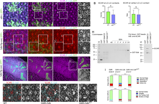 Sdk binds and regulates WRC localization and activity via its conserved C-terminal motif. (A)sdk mutant MARCM clones stained for SCAR, 26 h APF. (B) SCAR levels decrease cell-autonomously in the clones. SCAR levels at contacts: Mann-Whitney U test, P = .0356; SCAR levels at vertices/full contacts: Mann-Whitney U test, P = .1753; n = 30 WT contacts and 40 sdkΔ15contacts across three retinas each. (C and D) HA::Sdk expressing clones in retina, 26 h APF (C) and third instar wing imaginal disc (D). SCAR levels decrease cell-autonomously in the clones. (E–G) GMR-GAL4 (E), GMR>HA::Sdk (F), and GMR>HA::SdkΔCT (G) retinas stained for SCAR, 32 h APF. SCAR levels decrease broadly in the GMR>HA::Sdk eyes but are normal in HA::SdkΔCT eyes. Mechanosensory bristles do not express GMR-GAL4 (arrowheads). (H) Detection of Sdk–SCAR interaction using a GST pulldown assay. Left: Expression of GST alone, GST fused to the Sdk ICD (GST-SdkICD), and GST fused to the Sdk ICD with a deleted C-terminal motif (GST-SdkICDΔCT) were assessed using Coomassie-stained gels. Right: Equal levels of GST, GST-SdkICD, and GST-SdkICDΔCT were used to pull down SCAR from S2 cell lysates. SCAR formed a complex with SdkICD but not with the SdkICDΔCT deletion mutant. The experiment was repeated three times, and one representative result is shown. (I) Quantification of eye phenotypes induced by HA::Sdk and HA::SdkICDΔCT. Deletion of the Sdk C-terminal sequence motif reversed HA::Sdk induced phenotypes. χ2 test; **, P < 0.01; ***, P = 0.0001; ****, P < 0.0001. Scale bar, 10 μm. Source data are available for this figure: SourceData F4. Refer to the image caption for details.