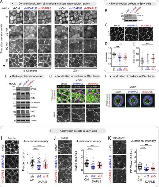 Loss of DAPLE impairs junctional morphology and actomyosin without altering the localization or abundance of junctional and apicobasal polarity markers. (A) Loss of DAPLE does not alter the formation of cell–cell junctions upon calcium-switch. MDCK cell monolayers seeded on filters were incubated for 18 h in medium with reduced Ca2+, and assembly of cell–cell junctions was induced by switching cells to medium containing Ca2+ for the indicated times. Cells stained for E-Cadherin and ZO-1, as indicated, were imaged by wide-field fluorescence microcopy. Representative pictures from three independent experiments are shown. (B–E) Loss of DAPLE alters cell–cell junction morphology in Eph4 cells. Eph4 cells stably expressing shCtrl (control), sh2DAPLE, or sh3DAPLE RNAi sequences were generated by lentiviral transduction and lysed for IB with the indicated antibodies (B). Confocal fluorescence microscopy images of ZO-1–stained Eph4 cells (C) were used to determine apical cell–cell junction linearity (D) or apical areas (E). Scatter plot values are for 90 cell–cell junctions (three experiments) in (D) or cells from 12 fields (three experiments) in E. Mean ± SD; ***, P < 0.001, Mann–Whitney U test. (F) Loss of DAPLE does not affect the total amount of junctional proteins. Monolayers of the MDCK cell lines (shCtrl, sh1DAPLE, or sh5DAPLE) were analyzed by IB as indicated. Representative results of two independent experiments are shown. (G) Loss of DAPLE does not perturb the localization of markers of apicobasal polarity in 2D cell cultures. Monolayers of the indicated MDCK cell lines (shCtrl, sh1DAPLE, or sh5DAPLE) were costained for Podocalyxin (apical membranes) and β-catenin (lateral membranes) or stained for PAR3 (apical junctions) and imaged by confocal fluorescence microscopy. For each staining, upper panels are perpendicular optical cross-sections, and lower panels are top views corresponding to maximum-intensity projections for Podocalyxin/β-catenin, or a single optical section for PAR3. Representative pictures from two experiments are shown. (H) Loss of DAPLE does not perturb the localization of markers of apicobasal polarity in 3D cell cultures. Cysts of the indicated MDCK cell lines (shCtrl, sh1DAPLE, or sh5DAPLE) were grown on Matrigel and costained for Podocalyxin and β-catenin before analysis by fluorescence confocal microscopy. Representative single optical sections of two independent experiments are shown. (I–K) Loss of DAPLE in Eph4 cells decreases the levels of junctional F-actin, NMIIB, and PP-MLC2. Monolayers of the indicated Eph4 cell lines (shCtrl, sh2DAPLE, or sh3DAPLE) were stained for F-actin (I), NMIIB (J), or PP-MLC2 (K) and analyzed by confocal fluorescence microscopy. Each panel depicts maximum-intensity projections of the apical domain (0.7 µm) and quantification graphs of fluorescence intensity at apical cell–cell junctions (scatter plots with mean ± SD for ∼60 cell–cell boundaries from three independent experiments; ***, P < 0.001, Mann–Whitney U test). All scale bars are 5 µm. Source data are available for this figure: SourceData FS1.