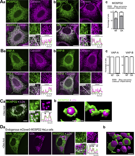 MOSPD2 is an endoplasmic reticulumlipid droplet tether functioning in LD homeostasis | Journal of Cell Biology | Rockefeller University Press MOSPD2 is an endoplasmic reticulumlipid droplet tether functioning in LD homeostasis | Journal of Cell Biology | Rockefeller University Press