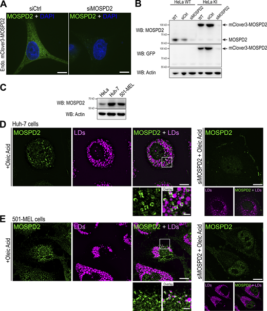 Characterization of CRISPR/Cas9 knock-in HeLa cells and endogenous localization of MOSPD2. (A) Live confocal images of HeLa cells expressing mClover3-MOSPD2 (green) at the endogenous level and transfected with control siRNAs (siCtrl) and siRNAs targeting MOSPD2 (siMOSPD2) to confirm the specificity of mClover3 signal. Scale bars: 10 µm. (B) Western blot (WB) analysis of MOSPD2 expression in WT (HeLa WT) and mClover3-MOSPD2 knock-in (HeLa KI) HeLa cells transfected with control siRNAs (siCtrl) and siRNAs targeting MOSPD2 (siMOSPD2). mClover3 was detected using anti-GFP antibodies. (C) Western blot analysis of MOSPD2 expression in HeLa, Huh-7, and 501-MEL cells. (D and E) Colocalization of endogenous MOSPD2 (labeled with anti-MOSPD2, in green) and LDs (labeled with LipidTOX, in magenta) in Huh-7 cells (D) or 501-MEL (E) after OA treatment. Panels on the right show the background signal of anti-MOSPD2 antibodies in cells transfected with siRNAs targeting MOSPD2 (siMOSPD2). Subpanels show the LD staining. Left: Subpanels on the bottom are higher magnification images of the area outlined. The overlay panel shows merged channels. Scale bars: 10 µm (insets, 2 µm). (A, D, and E) Images were acquired on a spinning-disk confocal microscope (Nikon CSU-X1, 100× NA 1.4). Source data are available for this figure: SourceData FS3.