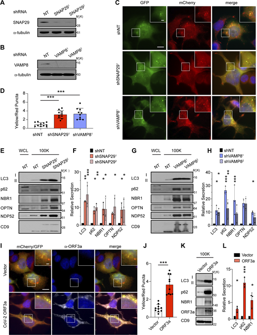 Genetic inhibition of autophagosome–lysosome fusion promotes the secretion autophagy cargo receptors via EVPs. (A) Lysate from cells stably expressing control shRNA or SNAP29 shRNA (SNAP291; SNAP292) was blotted for SNAP29 and α-tubulin. (B) Lysate from cells expressing control shRNA or VAMP8 shRNA (VAMP81; VAMP82) blotted for VAMP8 and α-tubulin. (C) Representative images of cells stably expressing the mCherry-EGFP-LC3 reporter and control shRNA (shNT), SNAP29 shRNA (shSNAP291), or VAMP8 shRNA (shVAMP81). Scale bar, 10 μm; inset scale bar, 2 μm. (D) Quantification of the ratio of double-positive (mCherry+;EGFP+) yellow puncta to mCherry only (mCherry+;EGFP−) red puncta in cells stably co-expressing the mCherry-EGFP-LC3 reporter and the indicated shRNAs from C. (mean ± SEM; shNT, n = 10; shSNAP291, n = 10, shVAMP81, n = 10; ***, P < 0.005). Statistics were calculated by nonparametric one-way ANOVA with Dunnett’s post hoc test. (E) Cell lysate (WCL; left) and 100,000 g EVP fractions (100K; right) from serum-starved cells expressing control shRNA (NT) or SNAP29 shRNA (shSNAP291; shSNAP292) was blotted for the indicated proteins. (F) Quantification of the proteins in EVPs from cells expressing SNAP29 shRNA relative to control shRNA (shNT) in E. Statistics were calculated by nonparametric one-way ANOVA with Dunnett’s post hoc test (mean ± SEM; n = 3; *, P < 0.05; **, P < 0.01; ***, P < 0.005). (G) WCL (left) and 100K fractions (right) from serum starved cells expressing control shRNA (NT) or VAMP8 shRNA (shVAMP81; shVAMP82) was blotted for the indicated proteins. (H) Quantification of the proteins in EVPs from cells expressing VAMP8 shRNA relative to control shRNA (shNT) in G. Statistics were calculated by nonparametric one-way ANOVA with Dunnett’s post hoc test (mean ± SEM; n = 3; *, P < 0.05; **, P < 0.01; ***, P < 0.005). (I) Representative images of cells that stably co-express the mCherry-EGFP-LC3 reporter and SARS-CoV-2 ORF3a (2xStrepTag) or vector controls stained with anti-StrepTag antibody. Scale bar, 10 μm; inset scale bar, 2 μm. (J) Quantification of the ratio of double-positive (mCherry+;EGFP+) yellow puncta to mCherry only (mCherry+;EGFP−) red puncta in cells stably co-expressing the mCherry-EGFP-LC3 reporter and ORF3a or vector in I. Statistical significance was calculated by unpaired two-tailed t-test (mean ± SEM; vector, n = 10; ORF3a, n = 10; ***, P < 0.005). (K) 100K fractions from serum starved cells expressing ORF3a (2xStrepTag) or vector were collected and blotted for the indicated proteins. (L) Quantification of LC3, p62, and NBR1 in EVPs from cells stably expressing ORF3a or vector in K. Statistics were calculated by unpaired two-tailed t test (mean ± SEM; n = 3; *, P < 0.05; ***, P < 0.005). Source data are available for this figure: SourceData F6. Refer to the image caption for details.