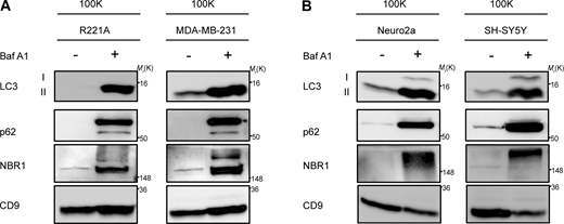 LC3 and autophagy cargo receptors are secreted in EVPs from diverse cell-types in response to lysosome inhibition. (A) 100,000 g EVP fractions (100K) from WT mouse R221A and human MDA-MB-231 breast cancer cell lines treated with vehicle or 20 nM BafA1 in serum-free media for 18 h were collected and blotted for indicated proteins (n = 3). (B) 100,000 g EVP fractions (100K) from WT mouse Neuro2a and human SH-SY5Y neuronal cell lines treated with vehicle or 20 nM BafA1 in serum free media for 18 h were collected and blotted for indicated proteins (n = 3). Source data are available for this figure: SourceData FS3. Refer to the image caption for details.
