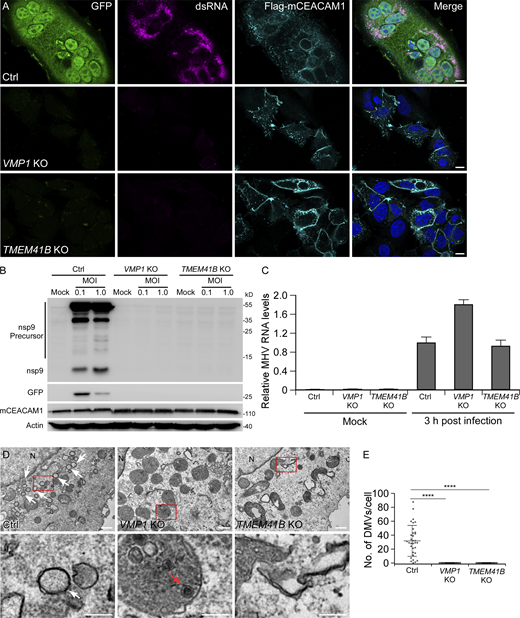 VMP1 and TMEM41B are required for β-coronavirus infection. (A) Immunostaining results show that GFP expression from an MHV-A59/GFP reporter virus and virus-specific dsRNA is detected in control (Ctrl) HeLa cells, but not in VMP1 KO or TMEM41B KO cells 9 h after MHV-A59 infection. Efficient expression of the MHV-A59 receptor Flag-mCEACAM1 is verified by immunostaining with Flag antibody. Bars: 10 μm. (B) 16 h after MHV-A59/GFP infection at the indicated multiplicity of infection (MOI), high levels of nsp9 precursors, mature nsp9, and GFP are detected in control HeLa cells, while no expression of nsp9 or GFP is detected in VMP1 KO or TMEM41B KO cells. The expression levels of mCEACAM1 are comparable in control and KO cells. (C) Control, VMP1 KO, and TMEM41B KO cells were infected with MHV-A59 for 3 h. Viral RNA levels were determined by quantitative PCR using virus-specific primers. Values were normalized to GAPDH mRNA levels (n = 3). (D and E) TEM analysis shows that numerous DMVs are observed in control cells 6 h after MHV-A59 infection. No DMVs are formed in VMP1 KO or TMEM41B KO cells (D). Virus (red arrow) is occasionally detected in endolysosomes of VMP1 KO cells. White arrows indicate DMVs. N, nucleus. Quantification of DMV numbers per cell is shown as mean ± SD (Ctrl, n = 33; VMP1 KO, n = 42; TMEM41B KO, n = 25; E). ****, P < 0.0001. Bars: 500 nm; inserts, 200 nm. Source data are available for this figure: SourceData F1.