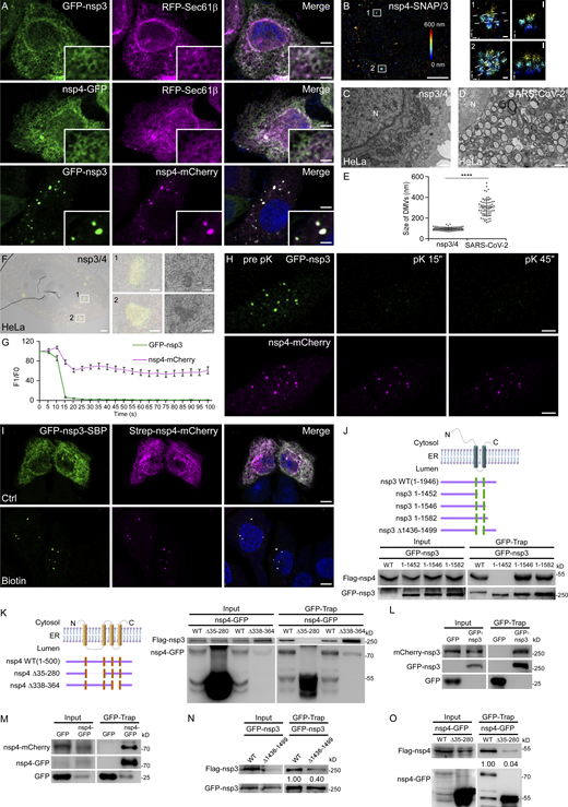 Ectopic expression of SARS-CoV-2 nsp3 and nsp4 is sufficient to induce DMVs. (A) In HeLa cells expressing GFP-nsp3 or nsp4-GFP alone, each protein shows a diffuse ER pattern and colocalizes with RFP-Sec61β. When cells are cotransfected with GFP-nsp3 and nsp4-mCherry, a large number of foci are observed, which are positive for both nsp3 and nsp4. Bars: 5 μm; inserts, 2 μm. (B) 3D-SMLM imaging of nsp4-SNAP co-transfected with GFP-nsp3 in a cell. The left panel shows the image of two nsp4 puncta in a large area with the z position color-coded. The middle panels show the x-y cross-sections of the boxed regions 1 and 2. The corresponding vertical cross-sections along the dotted lines are shown in the right panels. Bars: left panel, 5 μm; middle and right panels, 100 nm. (C–E) TEM images demonstrate that numerous DMVs are detected in HeLa cells coexpressing nsp3/4 (C). The sizes of DMVs formed during SARS-CoV-2 infection are larger than those induced by nsp3/4 expression (D). N, nucleus. Quantification of the size of DMVs is shown as mean ± SD (nsp3/4, n = 125; SARS-CoV-2, n = 71; E). ****, P < 0.0001. Bars: 500 nm. (F) CLEM images of a control cell expressing GFP-nsp3 and nsp4-mCherry. The left panel shows two nsp4 puncta in a large area. The middle and right panels show the boxed regions 1 and 2. Bars: left panel, 2 μm; middle and right panels, 500 nm. (G and H) In FPP assays, time-lapse images show that GFP-nsp3 puncta immediately disappear, while most of nsp4-mCherry puncta persist upon pK (proteinase K) addition in digitonin-permeabilized HeLa cells coexpressing nsp3/4 (H). Quantitative data (n = 11) are shown as mean ± SEM (G). Bars: 5 μm. (I) In most cells cotransfected with plasmids expressing GFP-nsp3-SBP and Strep-nsp4-mCherry, the two proteins show a diffuse ER pattern. After the addition of biotin for 24 h, GFP-nsp3-SBP and Strep-nsp4-mCherry form punctate structures. Bars, 5 μm. (J) The top panel shows a schematic of the topology of nsp3, and the structures of the nsp3 truncations. The bottom panel demonstrates that Flag–nsp4 is immunoprecipitated by WT GFP-nsp3, GFP-nsp3(1–1546), or GFP-nsp3(1–1582), but not GFP-nsp3(1-1452) in a GFP-Trap assay. (K) The left panel shows a schematic of the topology of nsp4 and the structures of the nsp4 truncations. The right panel demonstrates that Flag-nsp3 is immunoprecipitated by WT nsp4-GFP or nsp4(Δ338-364)-GFP, but not nsp4(Δ35-280)-GFP in a GFP-Trap assay. (L) In a GFP-Trap assay, mCherry-nsp3 is immunoprecipitated by GFP-nsp3. (M) In a GFP-Trap assay, nsp4–mCherry is immunoprecipitated by nsp4-GFP. (N) In a GFP-Trap assay, more Flag-nsp3 is immunoprecipitated by WT GFP-nsp3, compared with GFP-nsp3(Δ1436-1499). (O) In a GFP-Trap assay, more Flag-nsp4 is immunoprecipitated by WT nsp4-GFP, compared with nsp4(Δ35–280)-GFP. Source data are available for this figure: SourceData F2. Refer to the image caption for details.