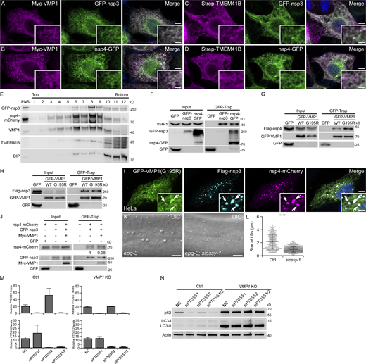 VMP1 interacts with nsp3 and nsp4, related to Figs. 4 and 5. (A) Immunostaining reveals that Myc-VMP1 colocalizes with GFP-nsp3 on the ER. Bars: 500 nm; insert, 200 nm. (B) Immunostaining reveals that Myc-VMP1 colocalizes with nsp4-GFP on the ER. Bars: 500 nm; insert, 200 nm. (C) Immunostaining reveals that Strep-TMEM41B colocalizes with GFP-nsp3 on the ER. Bars: 500 nm; insert, 200 nm. (D) Immunostaining reveals that Strep-TMEM41B colocalizes with nsp4-GFP on the ER. Bars: 500 nm; insert, 200 nm. (E) OptiPrep membrane flotation analysis of cells coexpressing GFP-nsp3 and nsp4-mCherry. PNS, post-nuclear supernatant. (F) In a GFP-Trap assay, endogenous VMP1 is immunoprecipitated by GFP-nsp3 or nsp4-GFP. (G) In a GFP-Trap assay, levels of Flag-nsp4 immunoprecipitated by GFP-VMP1 with the G195R mutation are increased, compared with WT GFP-VMP1. (H) In a GFP-Trap assay, levels of Flag-nsp3 immunoprecipitated by GFP-VMP1 or GFP-VMP1(G195R) are comparable. (I) Immunostaining reveals that GFP-VMP1(G195R) accumulates at the sites of Flag-nsp3/nsp4-mCherry puncta, as indicated by arrows. Bars: 500 nm; insert, 200 nm. (J) In a GFP-Trap assay, levels of nsp4-mCherry immunoprecipitated by GFP-nsp3 are comparable in control and Myc-VMP1-overexpressing cells. (K and L) The size of enlarged hypodermal LDs (arrows) in epg-3 mutant worms is dramatically reduced by pssy-1(RNAi) (K). Quantitative data are shown as mean ± SD (N2, n = 505; epg-3, n = 878; L). ****, P < 0.0001. Bars: 10 μm. (M) Quantitative PCR results show that the transcription of PTDSS1 or PTDSS2 is efficiently suppressed in siPTDSS1 or siPTDSS2 cells, respectively. mRNA levels of PTDSS1 and PTDSS2 are normalized by ACTB levels. (N) Immunoblotting results demonstrate that levels of p62 and LC3-I/II remain unchanged after single or double knock down of PTDSS1 and PTDSS2 in control and VMP1 KO HeLa cells. Source data are available for this figure: SourceData FS3. Refer to the image caption for details.