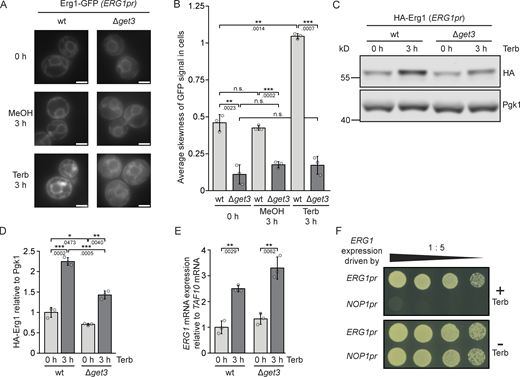 Lack of Get3 impairs the induction of Erg1 protein following a terbinafine-induced pulse of ERG1 mRNA expression. (A) Fluorescence microscopy images of WT and ∆get3 strains expressing genomically C-terminally GFP-tagged Erg1. Cells were imaged at the start of the experiment and 3 h after the addition of either 50 µg/ml terbinafine or as a control, methanol. Images are representative of three biological replicates with >100 cells imaged for each replicate. Scale bar: 2 µM. (B) Quantification of A. Bars represent the average of three biological replicates with individual data points shown as gray dots. Each point represents the average skewness of the distribution of the GFP signal in 100 cells from each sample as shown in A. Error bars indicate the standard deviation of the mean. The P values calculated using the two-sided Welch’s t test are shown with numbers and represented as follows: ** < 0.01; *** < 0.001. (C) Immunoblot of cell lysates from WT and ∆get3 strains expressing genomically N-terminally HA-tagged Erg1 before and after addition of terbinafine. Pgk1 serves as a loading control. Images are representative of three biological replicates. (D) Quantification of C. Bars represent the average of three biological replicates and individual data points are shown as gray dots. Error bars indicate standard deviation of the mean. The P values calculated using the two-sided Welch’s t test are shown with numbers and represented as follows: ** < 0.01; *** < 0.001. (E) RT-qPCR measurement of the expression level of ERG1 relative to the housekeeping gene TAF10 in WT and ∆get3 cells. Total RNA extracted from WT and ∆get3 strains before and after the addition of terbinafine was converted to cDNA and used as a template for the PCR reaction. Expression was normalized according to the housekeeping mRNA TAF10. Bars represent the average of three biological replicates with individual data points shown as gray dots, each of which is the average of three technical replicates. Error bars indicate standard deviation of the mean. The P values calculated using the two-sided Welch’s t test are shown with numbers and represented as follows: ** < 0.01. (F) Plate growth assay of strains in which the expression of ERG1 is under control of either its endogenous promoter (ERG1pr) or the promoter of NOP1 (NOP1pr). Strains were spotted out in a one-to-five dilution series on YPD plates with (+ Terb) and without (− Terb) 50 µg/ml terbinafine. The images are representative of three biological replicates. Source data are available for this figure: SourceData F4.