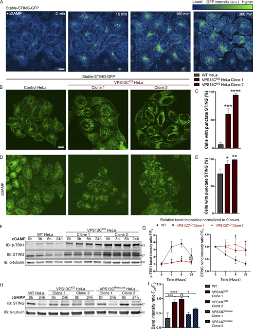 STING is activated and translocated out of the ER at baseline in VPS13CKOcells. (A) Selected frames from time lapse of stable STING-GFP in WT HeLa cells after treatment with 50 µg/ml cGAMP (Video 1). The GFP signal is shown using the “Green Fire Blue” lookup table in ImageJ, in which lower intensities are displayed in blue and higher intensities are displayed in green, a key for which is shown at top right. STING-GFP is localized in an ER-like pattern 0 min after treatment and traffics to a Golgi-like pattern 15 min after treatment, a Golgi/vesicular pattern by 180 min after treatment, and a largely vesicular pattern by 360 min. (B) Under unstimulated basal conditions, STING-GFP is localized in an ER distribution in WT HeLa cells but a vesicular distribution in the majority of VPS13CKO cells. (C) The percentage of cells with vesicular pattern is quantified in C. n = 3 biological replicates. (D and E) treatment with cGAMP had only minimal effect on the already punctate distribution of STING-GFP in VPS13CKO cells, but induces a vesicular pattern in the majority of WT cells (D), quantified in E. n = 3 biological replicates. (F) In WT cells, treatment with 8 µg/ml cGAMP causes an increase in p-TBK1 at 3 and 6 h time points and a return to baseline at 24 h, along with a concomitant decrease in total STING levels over 24 h as STING is degraded. In VPS13CKO cells, the same treatment fails to cause a significant increase in p-TBK1, STING upper band (phospho-STING), or decrease in total STING levels. (G) Band intensity of p-TBK1 and STING at each time point is quantified relative to the 0-h value for each cell line. For quantification of the STING bands, both the upper and lower band were included. All bands were normalized to the loading control. n = 3 biological replicates. (H and I) Treatment with 8 µg/ml cGAMP in VPS13CRescue cells for 24 h results in STING degradation closer to WT levels, but fails to induce significant STING degradation in VPS13CKO cells (H), quantified in I. n = 3 biological replicates. Scale bars, 20 μM. *, P < 0.05; **, P < 0.01; ***, P < 0.001; ****, P < 0.0001 compared with WT control. cGAMP time course data were compared using two-way ANOVA followed by FDR multiple comparisons testing. All other data were compared using two-sided t tests. Error bars represent ±SD. Source data associated with this figure can be found at https://doi.org/10.5281/zenodo.6416363. Source data are available for this figure: SourceData F5.