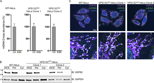 Control experiments for data shown in Fig. 4 and normal mtDNA nucleoid morphology in VPS13CKO cells. (A) qPCR of a D-Loop mtDNA amplicon relative to the nuclear gene hB2M shows efficient depletion of mtDNA after treatment with EtBr. The controls reflect each of the cell lines (WT, VPS13CKO clone 1, and VPS13CKO clone 2) grown in normal media. n = 3 biological replicates. (B) IB showing that mitochondrial marker HSP60 is present in the whole cell extract (WCE) and pellet (Pel) but absent in the cytosolic fraction (Cyt), while the cytosolic marker GAPDH is present in all fractions. (C) Immunofluorescence showing that mitochondria (magenta) and mtDNA nucleoids (green) have grossly normal morphology in VPS13CKO HeLa cells. Scale bar, 20 μm. Inset scale bars, 5 μm. Error bars represent ±SD. Source data associated with this figure can be found at https://doi.org/10.5281/zenodo.6416363. Source data are available for this figure: SourceData FS3.