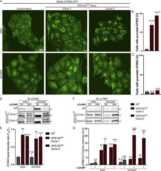 Silencing of cGAS unmasks cGAMP responsiveness and reveals impaired STING degradation in VPS13CKOcells. (A–C) Treatment with siRNA against cGAS returns STING-GFP to an ER distribution in VPS13CKO cells, similar to untreated WT cells (A), quantified in B, while siScr has no effect, quantified in C. n = 3 biological replicates. (D) IB against STING in WT and VPS13CKO cells treated with either scrambled siRNA or siRNA against CGAS, followed by treatment with 8 µg/ml cGAMP for 24 h. Treatment with siRNA against CGAS returns STING to the unphosphorylated state in VPS13CKO cells, rendering them responsive to cGAMP. In VPS13CKO cells, the activation of STING is not followed by degradation, compared with WT cells. (E) Quantification of the total STING signal remaining 24 h after cGAMP treatment (F24) relative to 0 h (F0). For quantification of the STING bands, both the upper and lower band were included. All bands were normalized to the loading control. n = 3 biological replicates. (F) IB against p-TBK1 under the same conditions as E. WT cells behaved similarly in response to cGAMP treatment regardless of siScr or siCGAS pretreatment, with p-TBK1 levels returning to baseline after 24 h of cGAMP treatment, as shown by the time course of Fig. 5, F and G. In VPS13CKO cells pretreated with siScr, p-TBK1 remained at baseline after 24 h of cGAMP treatment, presumably never having increased, based on the time course in Fig. 5, F and G. In VPS13CKO cells pretreated with siCGAS, however, p-TBK1 was significantly elevated after 24 h of cGAMP, in accordance with the defect in STING degradation and continued STING signaling (E and F). (G) Quantification of p-TBK1 band intensity. All bands were normalized to the loading control. n = 3 biological replicates. Scale bars, 20 μM. **, P < 0.01; ***, P < 0.001; ****, P < 0.0001 compared with untreated WT cells. ##, P < 0.01; ###, P < 0.001 value at 24-h cGAMP treatment compared with corresponding 0-h cGAMP treatment. Data were compared using two-sided t tests. Error bars represent ±SD. Source data associated with this figure can be found at https://doi.org/10.5281/zenodo.6416363. Source data are available for this figure: SourceData F6.