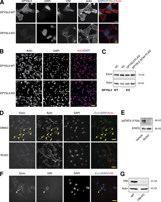 DPYSL2 is involved in arranging the lamellipodia structure. (A) DPYSL2 loss affects the cellular distribution of actin filaments. WT and DPYSL2-KO cells were subjected to immunofluorescence imaging using the indicated antibodies. Phalloidin was used to probe actin. Scale bar, 5 µm. (B) DPYSL2 loss affects the cellular distribution of actin filaments. WT and DPYSL2-KO cells were subjected to immunofluorescence imaging using phalloidin to probe actin. Scale bar, 50 µm. (C) DPYSL2 does not affect Ezrin’s expression level. Immunoblots representing WT MDA-MB-231 expressing VC, DPYSL2-KO, and overexpression of the full-length variant (DPYSL2-FLAG) or the C-terminal truncated (DPYSL2-ΔCter-FLAG) in the KO background. Cells were lysed and subjected to immunoblotting using the indicated antibodies. (D) The lamellipodia structure is disrupted upon inhibiting the JAK-STAT3 axis. MDA-MB-231 WT cells were starved with 0% FBS medium for 16 h and treated with 20 µM ruxolitinib (JAK1/2 inhibitor) for 12 h. The cells were subjected to immunofluorescence imaging using the indicated antibodies. Arrows indicate lamellipodia. Scale bar, 10 µm. (E) Immunoblots representing MDA-MB-231 cells treated with vehicle control or 20 µM ruxolitinib for 12 h. Cells were lysed and subjected to immunoblotting using the indicated antibodies. (F) Lamellipodia intactness is vimentin dependent. MDA-MB-231 cells, WT, and vimentin KO (VIM-KO). The VIM-KO cells are a polyclonal population in which cells expressing vimentin were not selected. These cells were subjected to immunofluorescence imaging using the indicated antibodies. Arrows indicate a cell expressing vimentin. Scale bar, 20 µm. (G) Immunoblots representing VIM-KO in MDA-MB-231 cells. Cells were lysed and subjected to immunoblotting using the indicated antibodies. Source data are available for this figure: SourceData FS6.