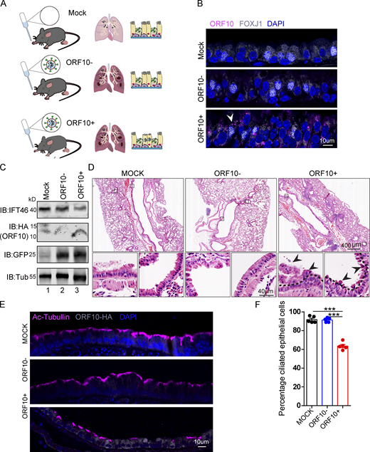 SARS-CoV-2 ORF10 infection impairs trachea cilia. (A) Schematic of the experimental design for the SARS-CoV-2 ORF10 infection system used in the present study. The dark pink lung symbols in rows two and three means virus infection. (B) ORF10 expression was detected in the trachea of hACE2 mice. Immunofluorescence analysis for HA (magenta) and FOXJ1 (white) was performed in Spike-lentivirus-ORF10 infected trachea. Nuclei were stained with DAPI (blue). The white arrowhead indicates FOXJ1 and ORF10 positive cells. (C) IFT46 was downregulated in mouse lungs after Spike-lentivirus-ORF10 infection. Immunoblotting analysis of IFT46, HA, and GFP was performed in mock, Spike-lentivirus, and Spike-lentivirus-ORF10 infected hACE2 mouse lungs. Tubulin served as a loading control. (D) Haematoxylin and eosin (H&E) staining of hACE2 lungs after mock, Spike-lentivirus (ORF10−), and Spike-lentivirus-ORF10 (ORF10+) infection. The black arrows indicate epithelial damage and the dashed lines indicate the boundary of the cilia layers. (E) ORF10 damaged the cilia layer in mouse trachea. Immunofluorescence analysis for Ac-Tubulin (magenta) and HA (white) was performed in mock, Spike-lentivirus, and Spike-lentivirus-ORF10 infected mice. Nuclei were stained with DAPI (blue). (F) Quantification ratio of ciliated epithelial cells in E (n = 5 independent experiments). Data are presented as the mean ± SEM. *** indicates P < 0.001. Statistical analysis was performed with two-tailed unpaired Student’s t test. Source data are available for this figure: SourceData F7.