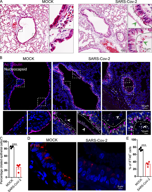 SARS-CoV-2 infection impairs bronchiole cilia. (A) H&E staining of hACE2 lungs after mock, and SARS-CoV-2 infection. The green arrowheads indicate epithelial damage. (B) SARS-CoV-2 infection damaged cilia layer in mouse bronchioles. Immunofluorescence analysis for Ac-Tubulin (magenta) and Nucleocapsid (white) of SARS-CoV-2 was performed in mock, and SARS-CoV-2 infected mice. Nuclei were stained with DAPI (blue). The white arrows indicate epithelial damage. (C) Quantification ratio of ciliated epithelial cells in B (n = 4 independent experiments). Data are presented as the mean ± SEM. *** indicates P < 0.001. Statistical analysis was performed with two-tailed unpaired Student’s t test. (D) SARS-CoV-2 infection influence the level IFT46 in mouse bronchioles. Immunofluorescence analysis for IFT46 (red) was performed in mock, and SARS-CoV-2 infected mice. Nuclei were stained with DAPI (blue). (E) Quantification of IFT46 positive cells in D. n = 4 independent experiments. Data are presented as the mean ± SEM. *** indicates P < 0.001. Statistical analysis was performed with two-tailed unpaired Student’s t test. Source data are available for this figure: SourceData F8. Refer to the image caption for details.