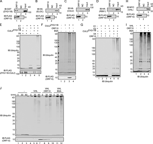 ORF10 specifically stimulates CUL2ZYG11Bactivity. (A) ZYG11B could interact with ORF10. Purified ORF10-FLAG was used to pull down GST-ZYG11B. (B) ELOC could not bind with ORF10. Purified ORF10-FLAG was used to pull down 6 × His-ELOC-HA. (C) CUL2 could not interact with ORF10. Purified ORF10-FLAG was used to pull down CUL2-HA. (D) RBX1 could not bind with ORF10. Purified ORF10-FLAG was used to pull down 6 × His-RBX1-HA. (E) Reconstitution of the CUL2ZYG11B ubiquitination system. Either E1, E2, ZYG11B-CUL2 immunocomplex, or Ub were withheld from the CUL2ZYG11B ubiquitination system in vitro. The reaction products were detected by immunoblotting with anti-ubiquitin and FLAG antibodies. (F) ORF10 stimulates the ubiquitination activity of CUL2ZYG11B. Either ORF10 or BSA was added to the CUL2ZYG11B ubiquitination system in vitro, which contains E1, E2, ubiquitin, ATP and ZYG11B-CUL2 immunocomplex. The reaction products were detected by immunoblotting with anti-ubiquitin and FLAG antibodies. (G) ORF10 is essential for the stimulation of CUL2ZYG11B ubiquitination activity. Either E1, E2, ZYG11B-CUL2 immunocomplex, Ub or ORF10 were withheld from the CUL2ZYG11B ubiquitination system in vitro. The reaction products were detected by immunoblotting with anti-ubiquitin antibody. (H) VHL could not bind with ORF10. Purified ORF10-FLAG was used to pull down 6 × His-VHL-MYC. (I) ORF10 could not stimulate the ubiquitination activity of CUL2VHL. Either ORF10 or BSA was added to the CUL2VHL ubiquitination system in vitro, which contains E1, E2, ubiquitin, ATP, and CUL2VHL. The reaction products were detected by immunoblotting with anti-ubiquitin antibody. (J) ORF10 has no effect on the ubiquitination activity of CUL2VHL. Either ORF10 or BSA was added to the CUL2VHL ubiquitination system in vitro, which contains E1, E2, ubiquitin, ATP, and CUL2VHL. The reaction products were collected at the indicated times, and reaction products were detected by immunoblotting with anti-ubiquitin and FLAG antibodies. Source data are available for this figure: SourceData FS1. Refer to the image caption for details.