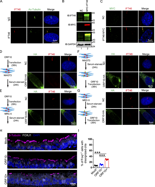 ORF10 perturbs the cilia localization of IFT46 during cilia formation and maintenance. (A) Immunofluorescence analysis for Ac-Tubulin (green) and IFT46 (red) was performed in NIH3T3 ciliated cells. Nuclei were stained with DAPI (blue). (B) Immunoblotting analysis of IFT46 and MYC was performed in IFT46-MYC expressing and empty-vector transfected cells. GAPDH served as a loading control. (C) Immunofluorescence analysis for MYC (green) and IFT46 (red) was performed in IFT46-MYC expressing and empty-vector transfected ciliated cells. Nuclei were stained with DAPI (blue). (D and E) ORF10 perturbs the cilium localization of IFT46. Immunofluorescence analysis for IFT46 (red) and HA (green) was performed in ORF10-expressing and empty-vector transfected NIH3T3 cells (D) or MRC-5 cells (E). Nuclei were stained with DAPI (blue). (F and G) The cilium localization of IFT46 is dysregulated in ORF10-expressing ciliated cells. Immunofluorescence analysis for HA (green) and IFT46 (red) was performed in ORF10-expressing and empty-vector transfected NIH3T3 cells (F) or MRC-5 cells (G). Nuclei were stained with DAPI (blue). (H) Immunofluorescence analysis for cilia in FOXJ1 positive epithelial cells. FOXJ1 is the marker of epithelial ciliated cells. (I) Quantification of FOXJ1 positive epithelial cells with disorganized cilia. n = 3 independent experiments. Data are presented as the mean ± SD. *** indicates P < 0.001. Statistical analysis was performed with two-tailed unpaired Student’s t test. Source data are available for this figure: SourceData FS5. Refer to the image caption for details.