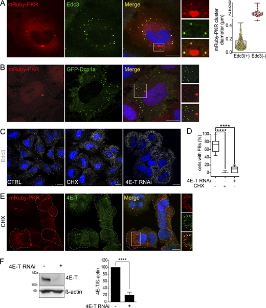Analysis of interdependence and colocalization of mRuby-PKR and PBs. (A) Representative immunofluorescence images showing two populations of mRuby-PKR clusters based on their diameter and association with Edc3. The image crop shows a close-up of these two populations. Scale bar: 10 µm. The right panel shows the quantification of the data (n = 30 cells). (B) Representative micrographs of fixed cells coexpressing mRuby-PKR and GFP-Dcp1a. The image crop shows two mRuby-PKR cluster populations, those that associate with GFP-Dcp1a and those that do not. Scale bar: 10 µm. (C) Representative immunofluorescence images showing pharmacological (CHX) or genetic (4E-T RNAi) knockdown of PBs assessed by Edc3 staining. Scale bar: 10 µm. (D) Quantification of the data in C. (N = 3 experiments, n > 500; ****, P < 0.0001, unpaired Student’s t test, nonparametric). (E) Representative micrographs showing that mRuby-PKR clusters recruit 4E-T after pharmacologic depletion (CHX) of PBs. Scale bar: 10 µm. (F) Western blot showing the extent of knockdown of 4E-T KD by RNAi. Right: Quantification of the data (mean and SEM, N = 3 experiments; ****, P < 0.0001, unpaired Student’s t test, nonparametric). Source data are available for this figure: SourceData FS2.