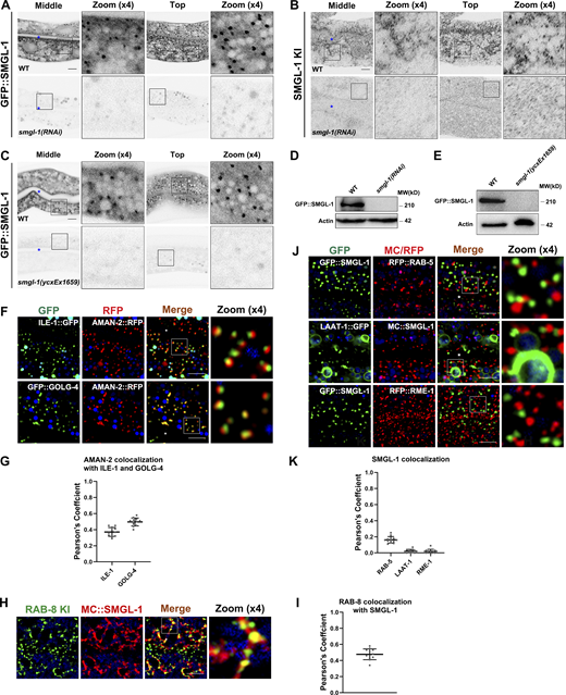 SMGL-1 resides in the ER-Golgi intermediate compartment and neighboring RAB-8-positive structures. (A–E) In smgl-1(RNAi) animals or smgl-1(ycxEx1659) mutants, the expression levels of GFP::SMGL-1 and endogenous SMGL-1 were decreased. (F and G) The intracellular juxtaposition between AMAN-2 and ILE-1 or GOLG-4. (H and I) Endogenous RAB-8 colocalized with MC::SMGL-1. (J and K) SMGL-1-positive puncta were separable from RAB-5, LAAT-1, and RME-1. Pearson’s correlation coefficients for GFP and mCherry signals were calculated (n = 12 animals). The signals from the apical membrane were avoided by manual ROI selection. Scale bars: 10 μm. Colored asterisks indicate intestinal lumen. Source data are available for this figure: SourceData FS4. Refer to the image caption for details.