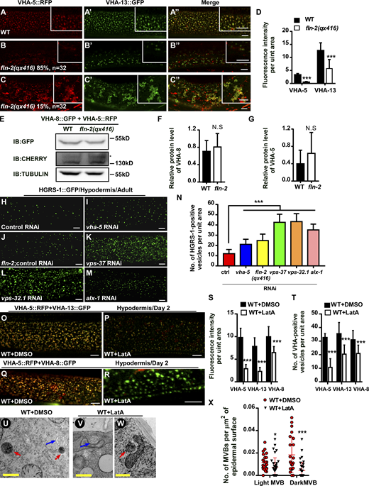 FLN-2 and actin cytoskeleton are required for MVB formation. (A–D) Confocal fluorescence images of the epidermis in WT (A–A″) and fln-2 (B–C″) co-expressing VHA-5::RFP and VHA-13::GFP at adult day 2. Average fluorescence intensity of VHA-5 and VHA-13 is quantified in D. At least 17 animals were scored in each strain. (E–G) The protein levels of VHA-5::RFP and VHA-8::GFP are unaltered in fln-2. Three independent immunoblot experiments were performed; E shows a representative result. (H–N) Confocal fluorescence images of the epidermis in WT animals expressing HGRS-1::GFP with the indicated RNAi treatments at adult day 2. The number of HGRS-1–positive vesicles per unit area (238 μm2) was quantified and shown in N. At least 14 animals were scored in each strain. (O–R) Merged confocal fluorescence images of the epidermis in WT day 2 adults co-expressing VHA-5::RFP and VHA-13::GFP (O and P) or VHA-8::GFP (Q and R) treated with either DMSO or LatA. (S and T) Mean fluorescence intensity and number of VHA-5–, VHA-13–, or VHA-8–positive vesicles per unit area (134 μm2) under the indicated treatments. 15 animals were scored in each treatment condition. (U–X) Representative TEM images of MVBs in the epidermis of WT day 2 adults treated with DMSO (U) or LatA (V and W). The number of MVBs per µm2 of epidermis in the indicated treatments is shown in X. 23 and 32 cross sections were quantified under DMSO and LatA treatment, respectively. In D, F, G, N, S, T, and X, data are shown as mean ± SD. Unpaired two-tailed Student’s t test was performed to compare mutant datasets with WT or control treatment or datasets that are linked by lines. *, P < 0.05; ***, P < 0.001. Scale bars, 5 μm in A–C″, H–M, and O–R; 500 nm in U–W. Source data are available for this figure: SourceData FS2.