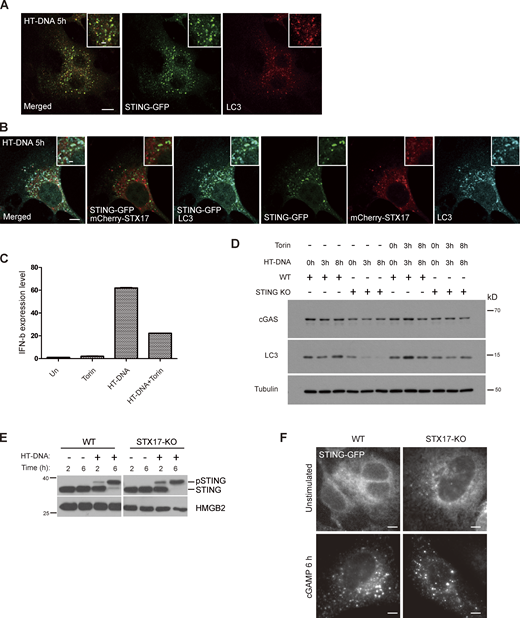 STX17 and STING translocate to different types of autophagic vacuoles upon DNA stimulation. (A) LC3 is recruited to STING positive vesicles. MEFs stably expressing STING-GFP was treated with HT-DNA for 5 h and stained with GFP and LC3 antibody. Scale bar for large images, 5 µm; Scale bar for inset images, 1 µm. (B) STX17 translocates to STING negative but LC3 positive vesicles. MEFs stably expressing STING-GFP and mCherry-STX17 were treated with HT-DNA for 5 h and stained with GFP, mCherry, and LC3 antibody. Scale bar for large images, 5 µm; Scale bar for inset images, 1 µm. (C) mTOR inhibition negatively regulates DNA-induced IFNβ expression. WT cells were treated with Torin 1, HT-DNA, or HT-DNA plus Torin 1 for 5 h, and the indicated RNAs was extracted for qPCR. (D) STING mediates HT-DNA–induced autophagic response. WT and STING-KO MEFs were treated with HT-DNA or HT-DNA with Torin 1 for 3 or 8 h. Cells were lysed and analyzed for immunoblotting with indicated antibodies. (E) STX17 is not required for STING degradation. WT and STX17 knock out cells were treated with HT-DNA for 2 or 6 h. Cells were collected for immunoblotting with the indicated antibodies. (F) STING translocates to vesicles upon cGAMP stimulation. WT and STX17 knock out cells stably expressing STING-GFP were treated with cGAMP for 6 h and then fixed for immunostaining. Scale bar, 5 µm. Source data are available for this figure: SourceData F10.