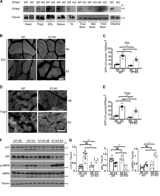 STING deficiency boosts exercise-induced autophagy in mice. (A) STING expression was examined in the indicated tissues of WT mice and STING KO mice. (B–E) Representative images of GFP-LC3 puncta in mouse skeletal muscle, including the extensor digitorum longus (EDL; B) and vastus lateralis (thigh; D) of GFP-LC3 WT and STING KO mice before and after exercise. NE, no exercise; EX, exercise. (C and E) Quantification of data (mean ± SEM of 10 tissue sections) in B and D. *, P ≤ 0.05; **, P ≤ 0.01; ****, P ≤ 0.0001. Scale bar, 20 µm. (F) Immunoblot analysis of autophagic flux and AMPK phosphorylation (p-AMPK Thr172) in vastus lateralis muscle from three mice of the indicated genotypes before and after exercise. (G) Quantitative analysis of autophagy and AMPK activities upon exercise. Immunoblot analysis of autophagic flux and AMPK phosphorylation (p-AMPK Thr172) in vastus lateralis muscle from mice of the indicated genotypes before and after exercise, n value as indicated below. Data are represented as mean ± SEM. Unpaired two-tailed t test was used to compare different genotype for each condition. Two-way ANOVA for magnitude of changes between different conditions in mice of different genotypes. *, P ≤ 0.05; **, P ≤ 0.01; ****, P ≤ 0.0001. Source data are available for this figure: SourceData F3. Refer to the image caption for details.