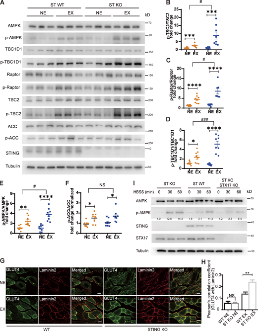 STING depletion promotes AMPK and its substrates activation in mice muscle. (A–F) Representative Western blots (n = 3; A) and quantification (n = 6–8) of the phosphorylation of AMPK (at Thr172; B) and its substrates TBC1D1 (at Ser237; C), Raptor (at Ser792; D), TSC2 (at Ser1387; E), and ACC (at Ser79; F) in gastrocnemius muscles from indicated genotypes before and after exercise. Data are represented as mean ± SEM. ST, STING; NE, non-exercise; EX, exercise; NS, not significant. *, P ≤ 0.05; **, P ≤ 0.01; ***, P ≤ 0.001; ****, P ≤ 0.0001. Unpaired two-tailed t test for comparison of two groups. Two-way ANOVA for comparison of magnitude of changes between different groups in mice of different genotypes. #, P ≤ 0.05; ###, P ≤ 0.001. (G) Increased GLUT4 translocation to plasma membrane in STING KO mice after exercise. Representative images of GLUT4 co-localization of Laminin2 in tibialis anterior muscles (n = 4). Scale bar, 20 μm. (H) Quantification of GLUT4 co-localization of laminin2 in tibialis anterior muscles (n = 4; G) are represented as mean ± SEM. An area of 220.5 mm2 per mouse was evaluated. NS, not significant; **, P ≤ 0.01. Unpaired two-tailed t test for comparison of two groups. (I) AMPK activation analysis in STING WT, STING KO, and STING KO–STX17 KO cells. The STING WT, STING KO, and STING/STX17 DKO MEF cells were incubated in full medium or HBSS for the indicated time. AMPK phosphorylation (at Thr172) was detected by Western blot. Representative images were shown. The experiments were repeated three times and similar results were observed. Normalized fold change of p-AMPK/AMPK was listed. Source data are available for this figure: SourceData F4. Refer to the image caption for details.