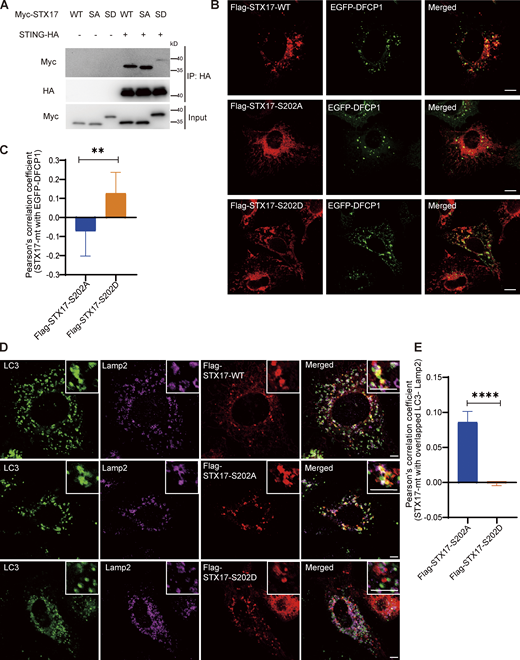 The phosphorylation of STX17 on S202 by TBK1 releases STX17 from STING and distributes STX17 to distinct structures. (A) STING interaction with STX17 was inhibited TBK1 phosphorylation on STX17 S202. HEK293T cells were transfected with empty vector or STING-HA, combined with Flag-STX17-WT or Flag-STX17-S202A (SA) or Flag-STX17-S202D (SD) as indicated. 24 h after transfection, cells were lysed and immunoprecipitated with anti-HA agarose resin. (B) Flag-STX17-S202D co-localized with phagophore structure to a larger extend. U2OS cells were transfect with Flag-STX17 or Flag-STX17-S202A or Flag-STX17-S202D, combined with EGFP-DFCP1. After treated with Torin 1 for 3 h, cells were fixed and stained by indicated antibody and imaged by confocal microscopy. Representative images were shown. Scale bar, 10 µm. (C) Statistics result of B, representing co-localization between Flag-STX17-S202A or Flag-STX17-S202D with EGFP-DFCP1 in U2OS cells co-expressing plasmids as indicated and treated with Torin 1 for 3 h. At least 30 cells were analyzed. Data were mean ± SD. **, P ≤ 0.01. Unpaired two-tailed t test for comparison of two groups. (D) Flag-STX17-S202A better co-localized with complete autophagosome. U2OS cells were transfected with Flag-STX17 or Flag-STX17-S202A or Flag-STX17-S202D. After being treated with Torin 1 for 3 h, cells were fixed and stained by indicated antibody and imaged by confocal microscopy. Representative images were shown. Scale bars for both large and inset images, 10 µm. (E) Statistics result of D, representing co-localization between Flag-STX17-WT or Flag-STX17-S202A or Flag-STX17-S202D with overlapped LC3-Lamp2 area in U2OS cells expressing plasmids as indicated and treated with Torin 1 for 3 h. At least 30 cells were analyzed. Data were mean ± SD. ****, P ≤ 0.0001. Unpaired two-tailed T test for comparison of two groups. Source data are available for this figure: SourceData F8.