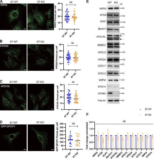 STING has not influence on autophagosome initiation and canonical autophagy regulators. (A–C) STING WT or KO MEF cells were treated with Torin 1 for 3 h before immunostaining by anti-WIPI2 (A), FIP200 (B), or ATG16L (C) primary antibodies and secondary antibodies. Images were taken by confocal microscopy. Representative images were shown on left panels. Right panels show the quantification of puncta number for the indicated proteins. Scale bar, 10 µm. Data are represented as mean ± SD for at least 30 cells. NS, not significant. Unpaired two-tailed t test for comparison of two groups. (D) STING WT and STING KO MEFs were transfected with GFP-DFCP1 for 24 h, then treated with Torin 1 for 3 h before fluorescence of GFP-DFCP1 was imaged by confocal microscopy. Representative images were shown on left panels. Right panels show the quantification of puncta number of the indicated proteins. Data are represented as mean ± SD for at least 30 cells. NS, not significant. Unpaired two-tailed t test for comparison of two groups. (E) Canonical autophagy regulator expression level analysis in STING WT or STING KO MEF cells. STING WT and STING KO MEF cells were collected and lysed for Western blotting by the indicated antibodies. (F) Quantification of three independent repeats of E. Data are represented as mean ± SD. NS, not significant; ST, STING. Unpaired two-tailed t test for comparison of two groups. Source data are available for this figure: SourceData FS2. Refer to the image caption for details.