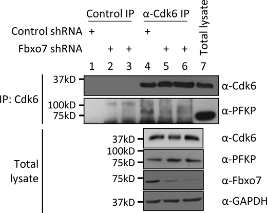 Cdk6 immunoprecipitation (IP) from MOLT-4 cells expressing control or Fbxo7 shRNA. PFKP co-immunoprecipitation was analyzed by immunoblot (n = 1). Source data are available for this figure: SourceData FS2.
